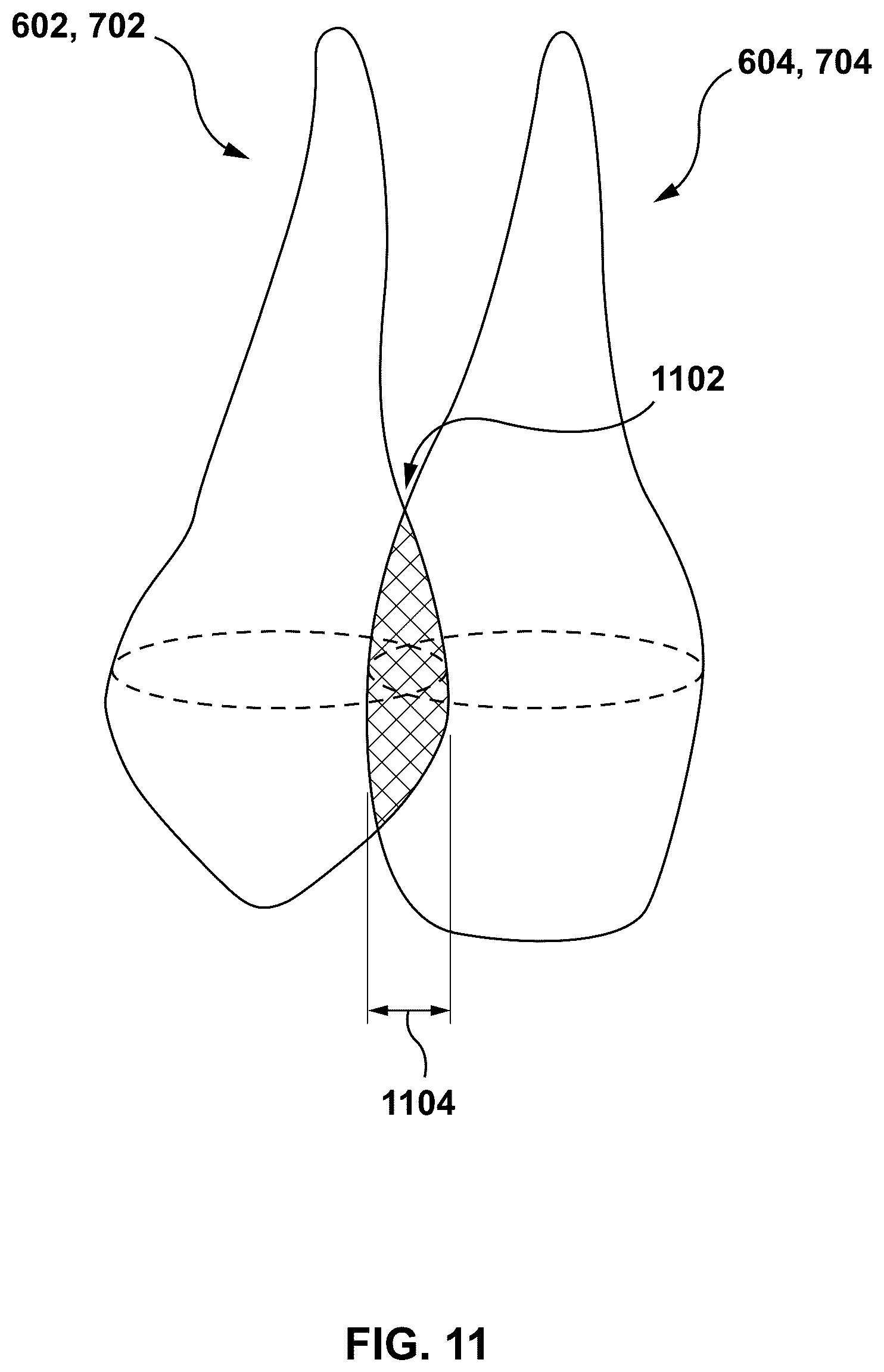 Patent US12303347 Figure 10 – Methods and systems for determining an orthodontic treatment