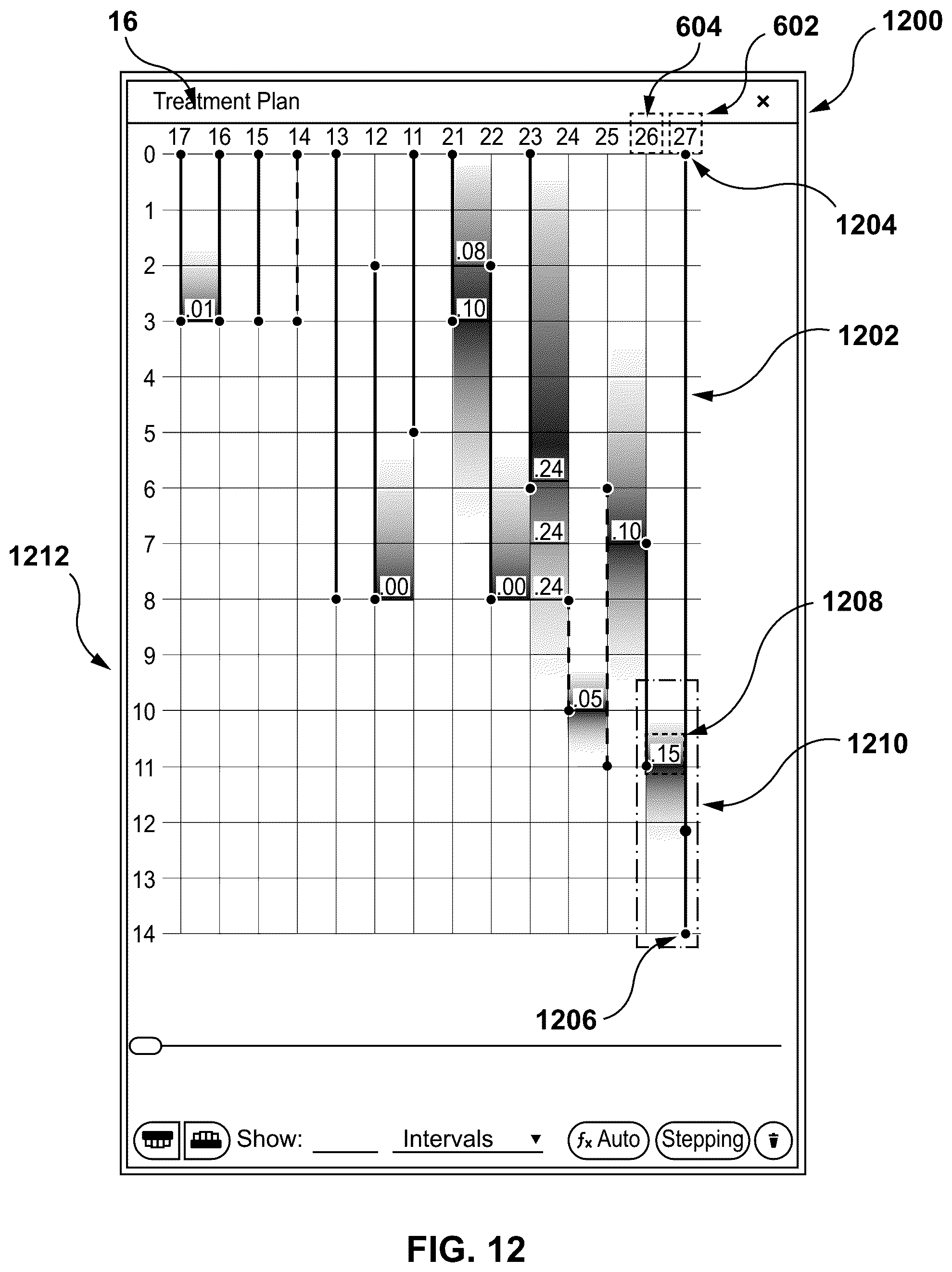 Patent US12303347 Figure 11 – Methods and systems for determining an orthodontic treatment