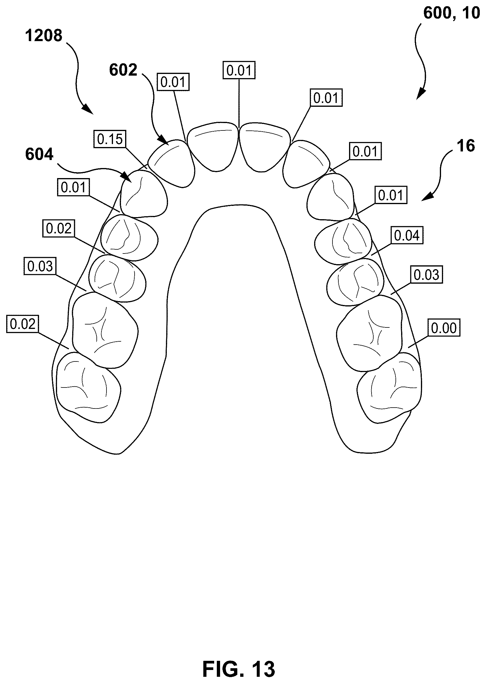Patent US12303347 Figure 12 – Methods and systems for determining an orthodontic treatment