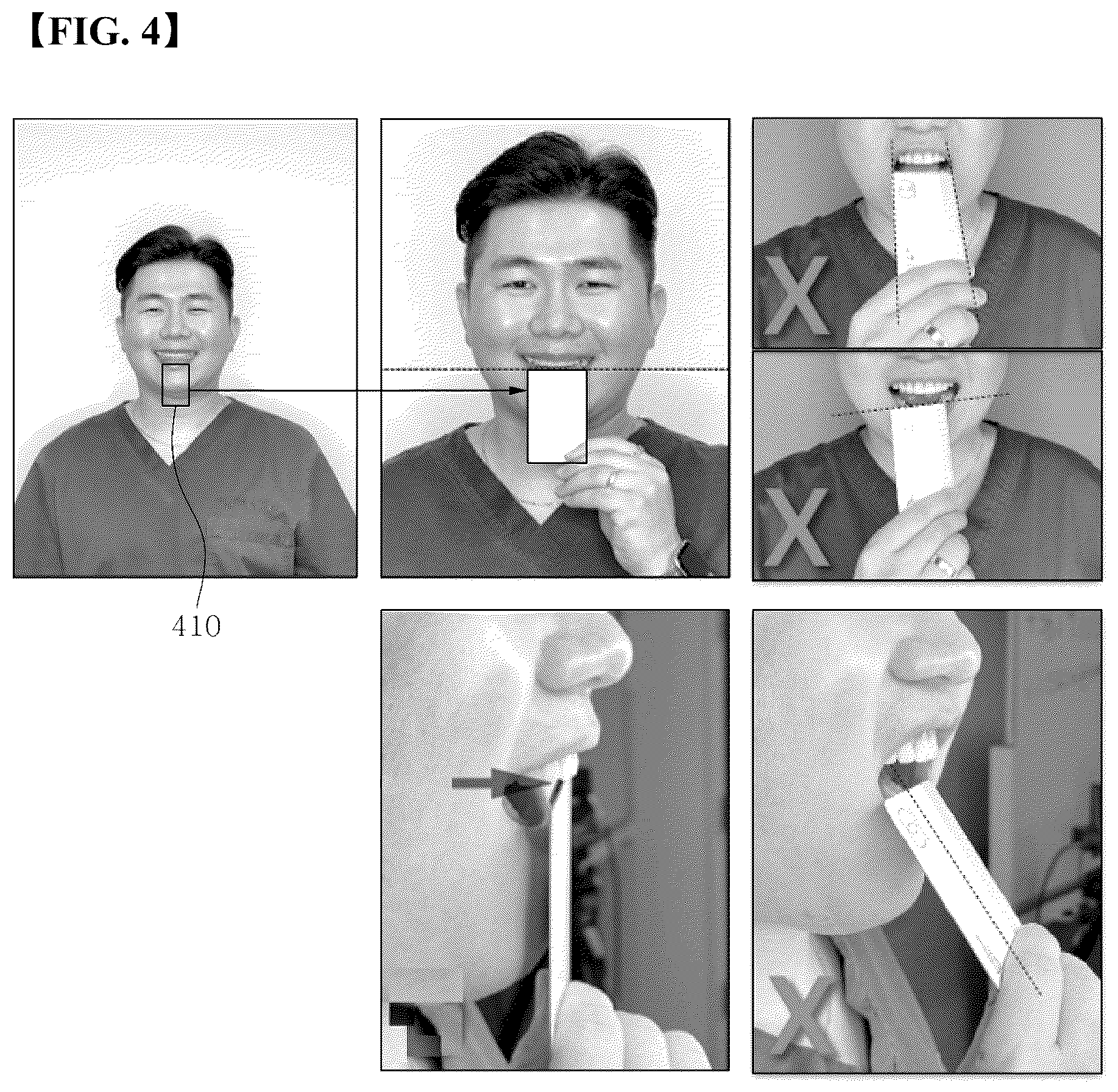 Patent US12303348 Figure 3 – Generating a 3D tooth modeling file adjusted for tooth size for manufacturing a 3D dental laminate