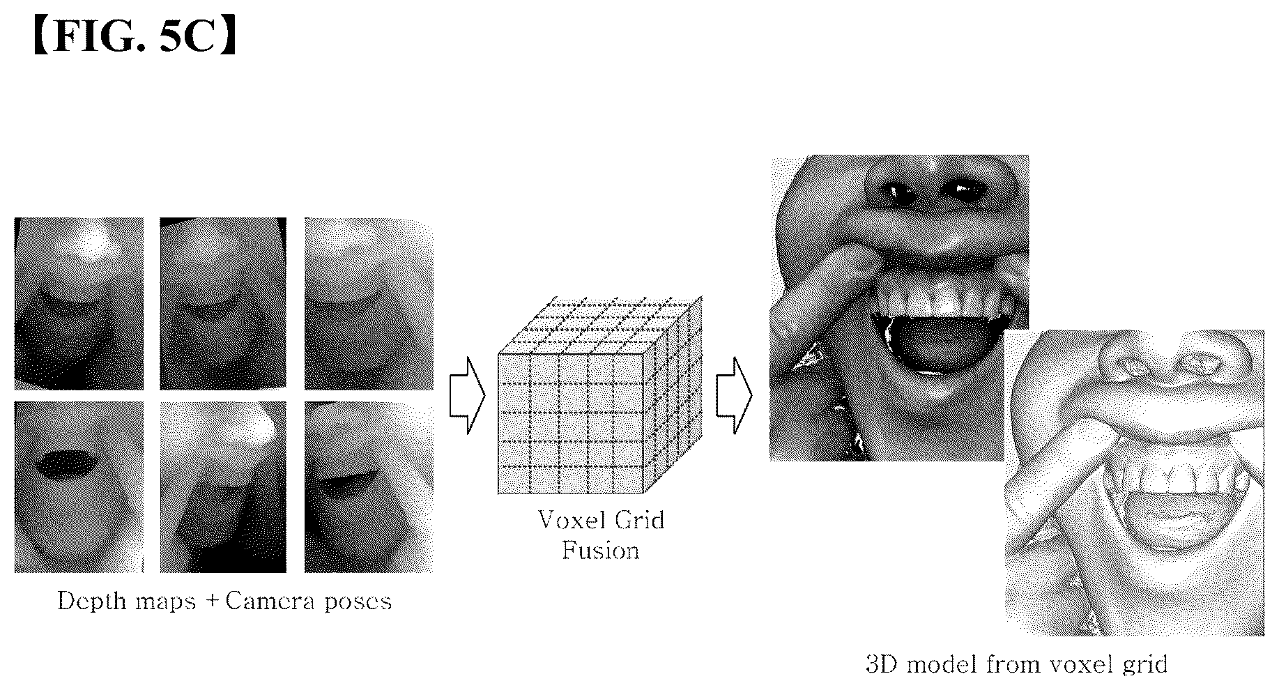 Patent US12303348 Figure 5 – Generating a 3D tooth modeling file adjusted for tooth size for manufacturing a 3D dental laminate