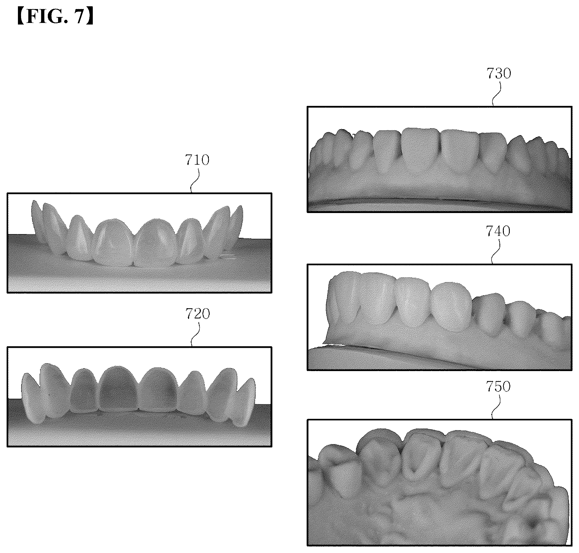 Patent US12303348 Figure 7 – Generating a 3D tooth modeling file adjusted for tooth size for manufacturing a 3D dental laminate
