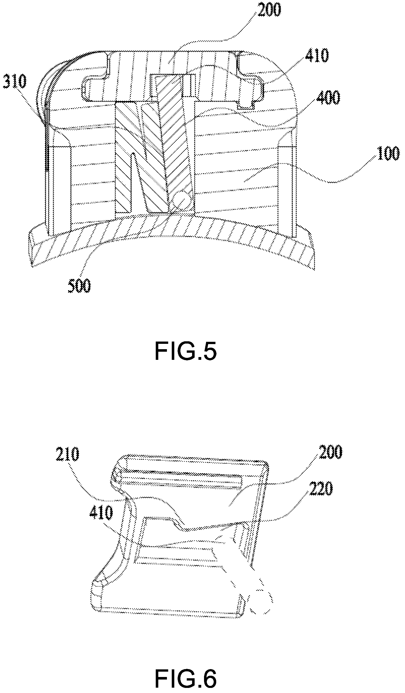 Patent US12303349 Figure 4 – Orthodontic appliance