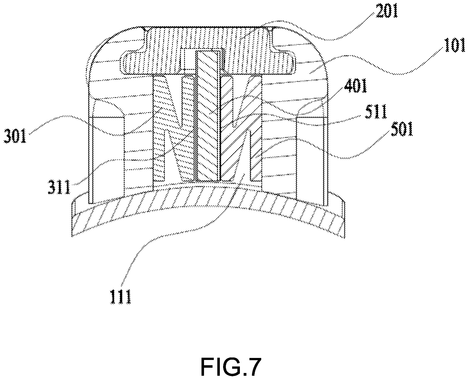 Patent US12303349 Figure 5 – Orthodontic appliance