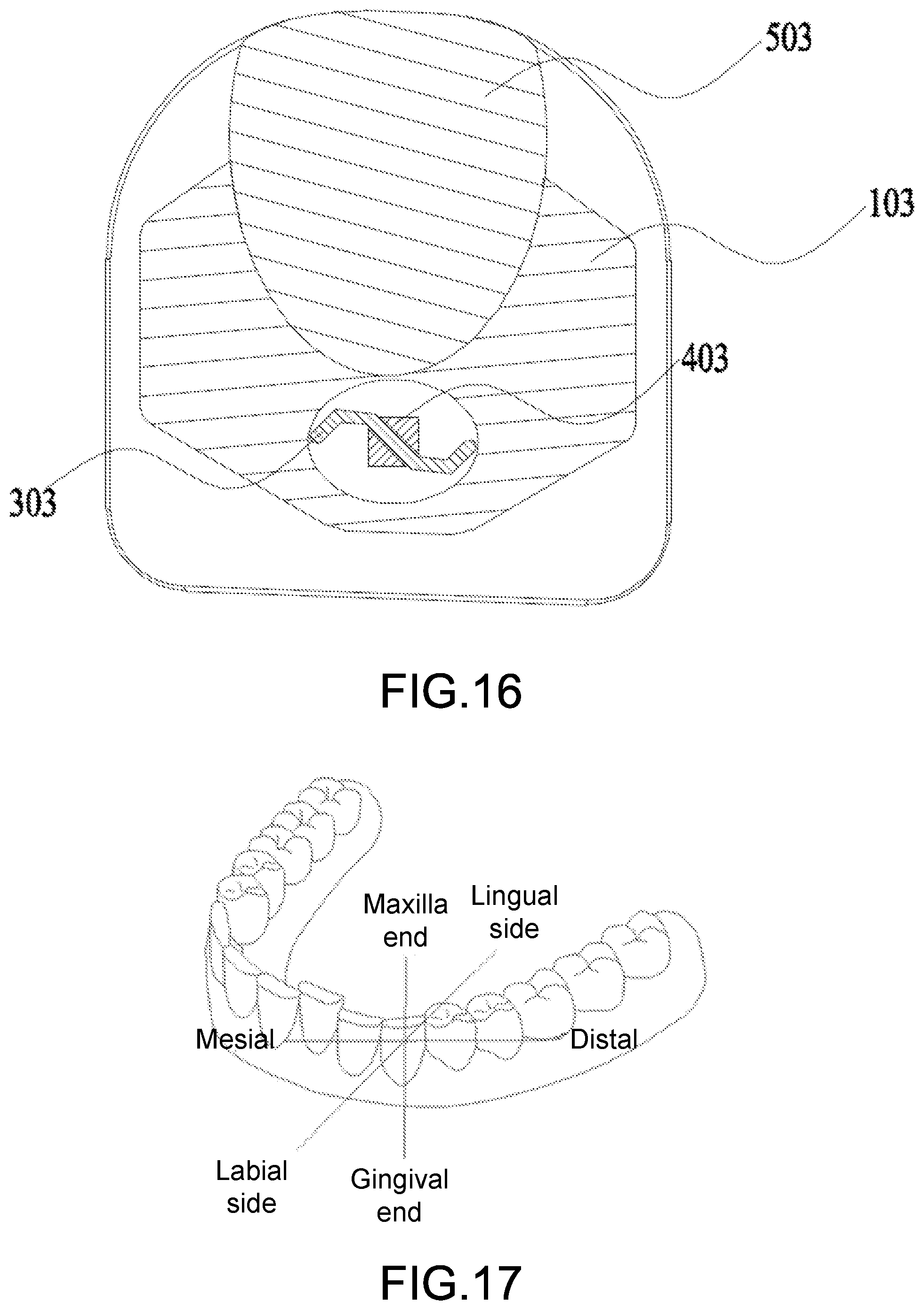 Patent US12303349 Figure 11 – Orthodontic appliance
