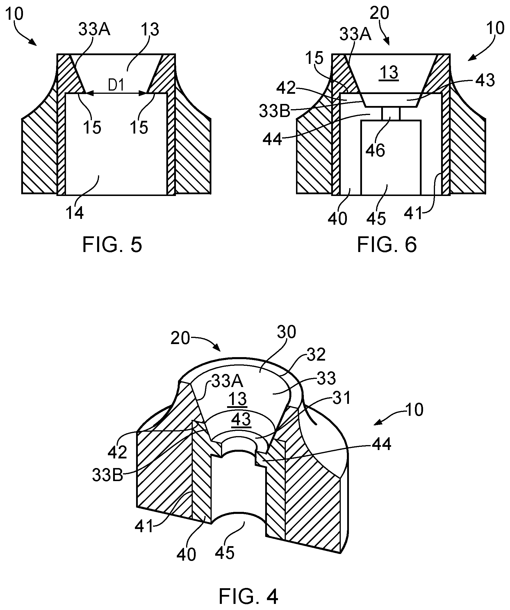 Patent US12303351 Figure 2 – Dental prosthesis