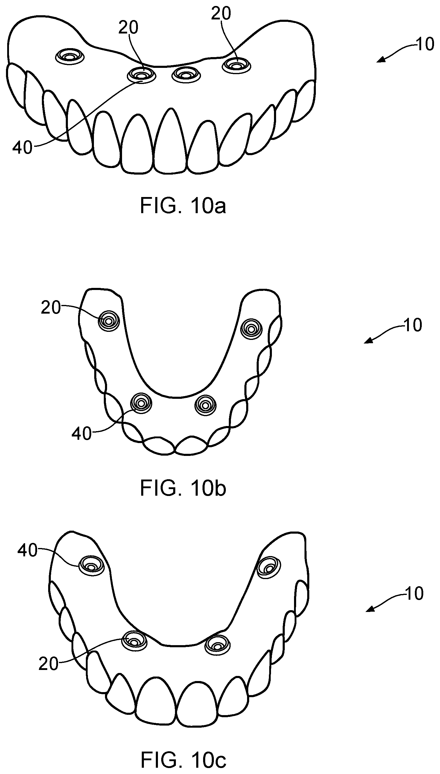 Patent US12303351 Figure 4 – Dental prosthesis