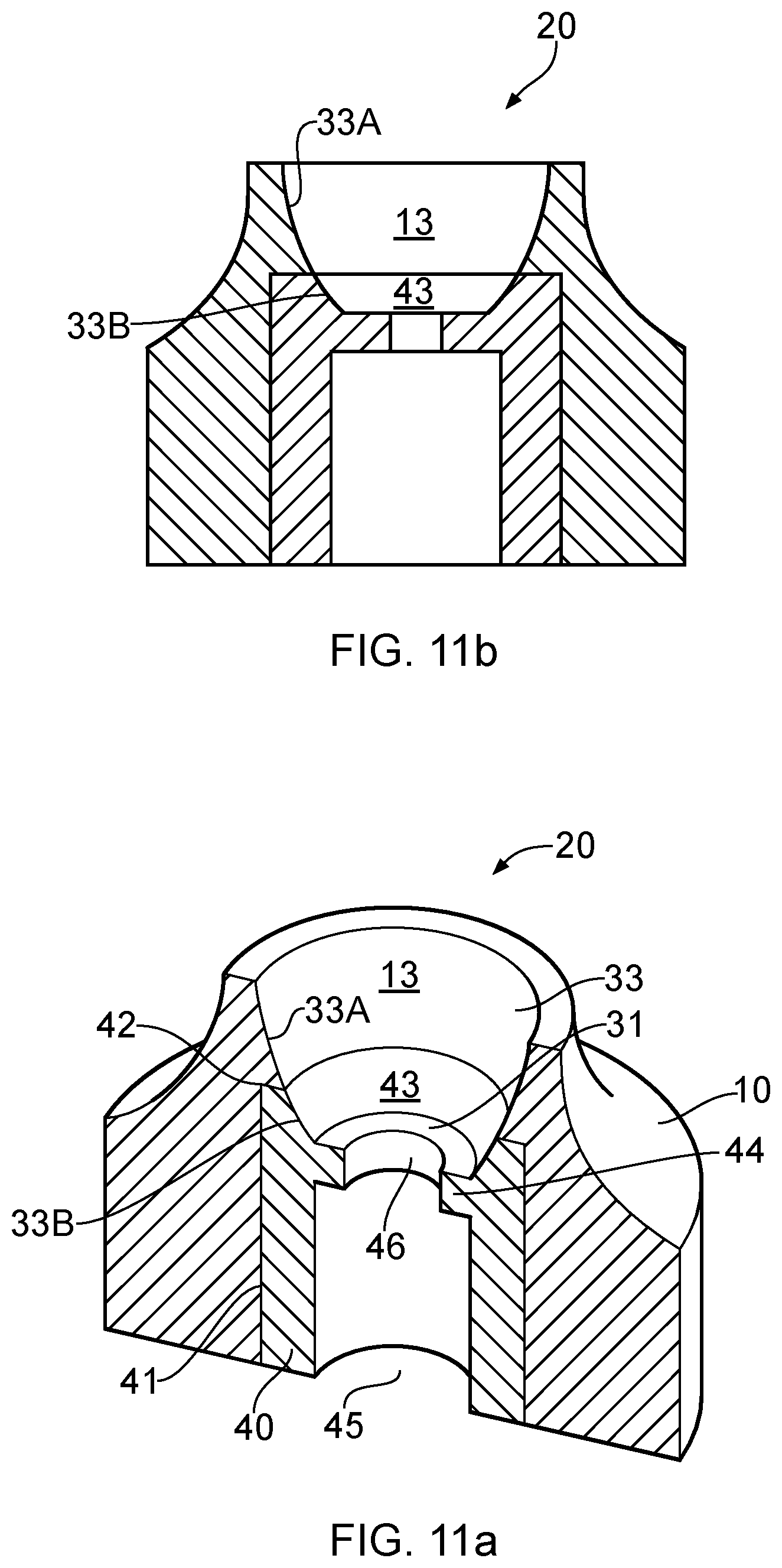 Patent US12303351 Figure 5 – Dental prosthesis
