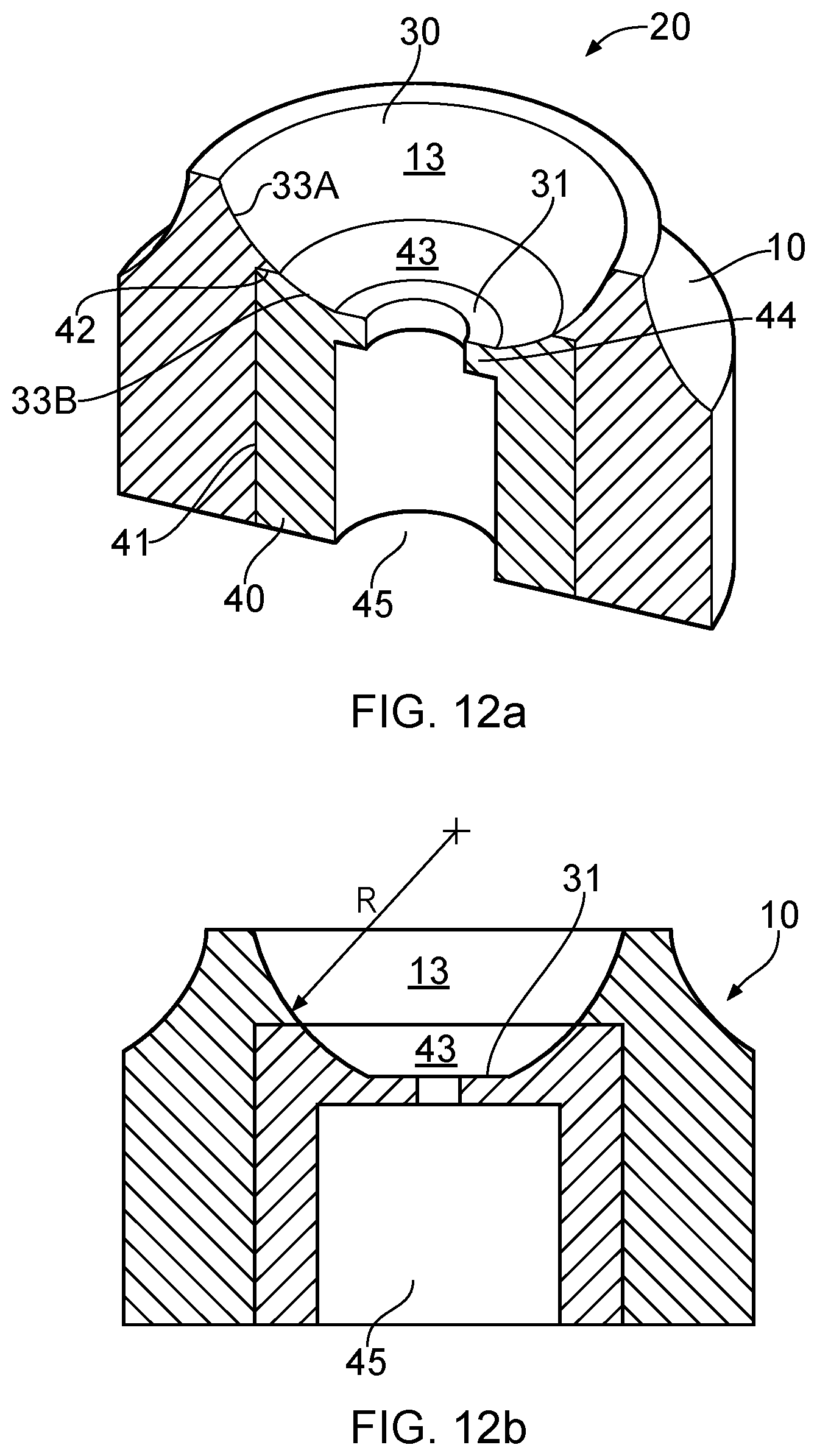 Patent US12303351 Figure 6 – Dental prosthesis