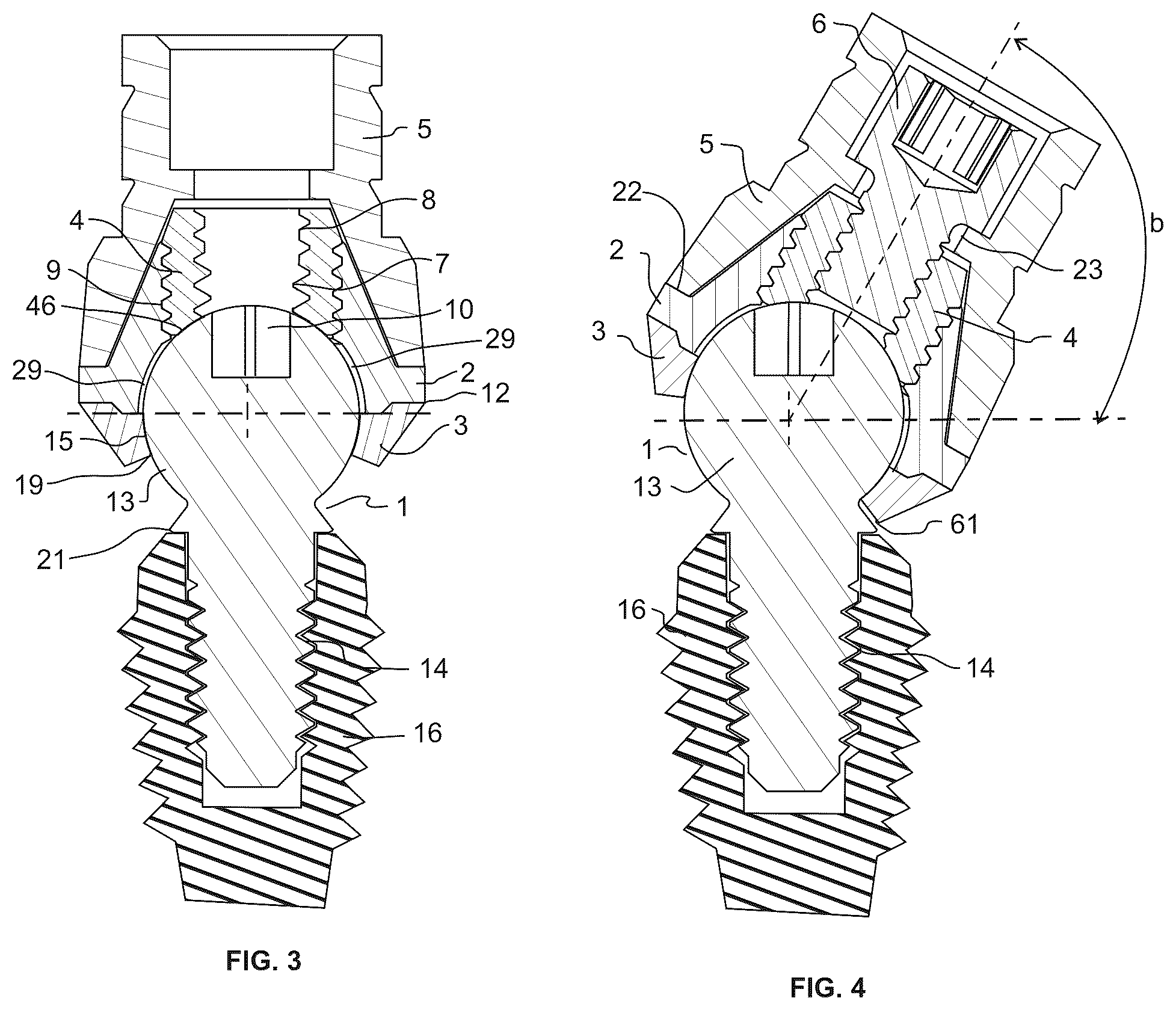 Patent US12303352 Figure 2 – Omni-directional multi-unit abutment dental systems
