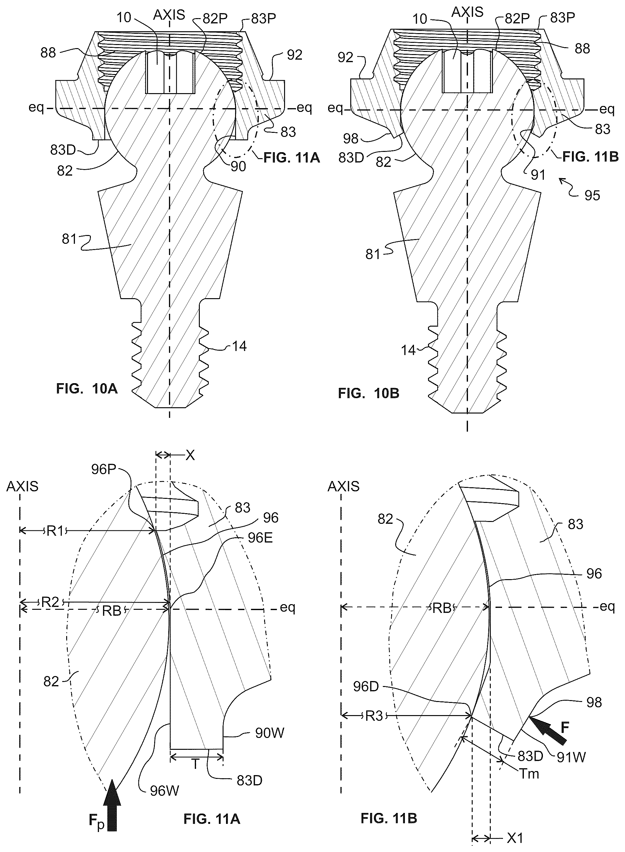 Patent US12303352 Figure 5 – Omni-directional multi-unit abutment dental systems