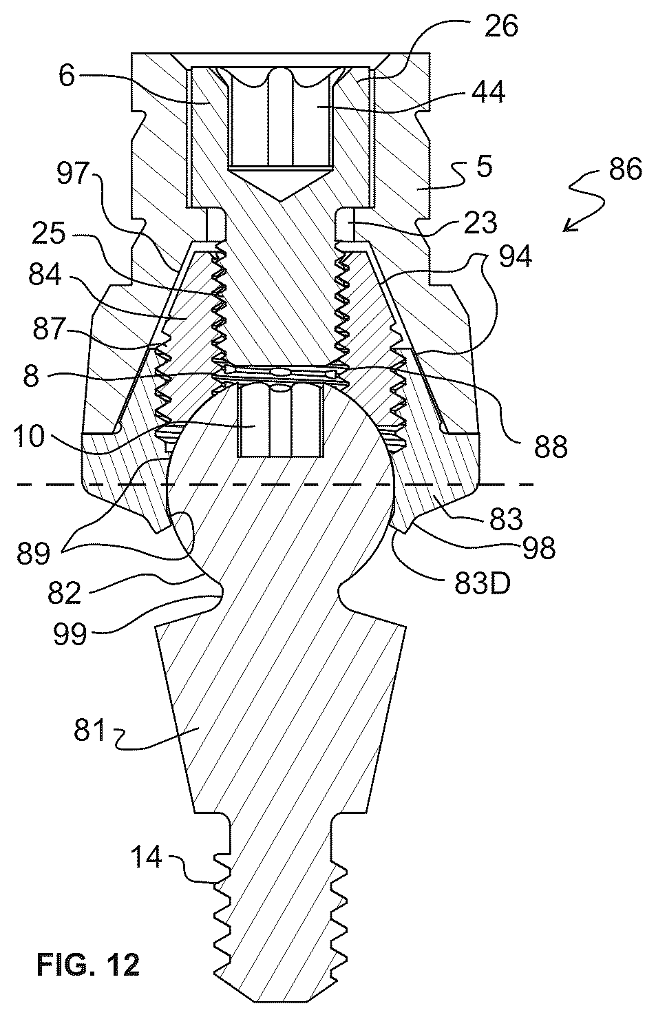 Patent US12303352 Figure 6 – Omni-directional multi-unit abutment dental systems