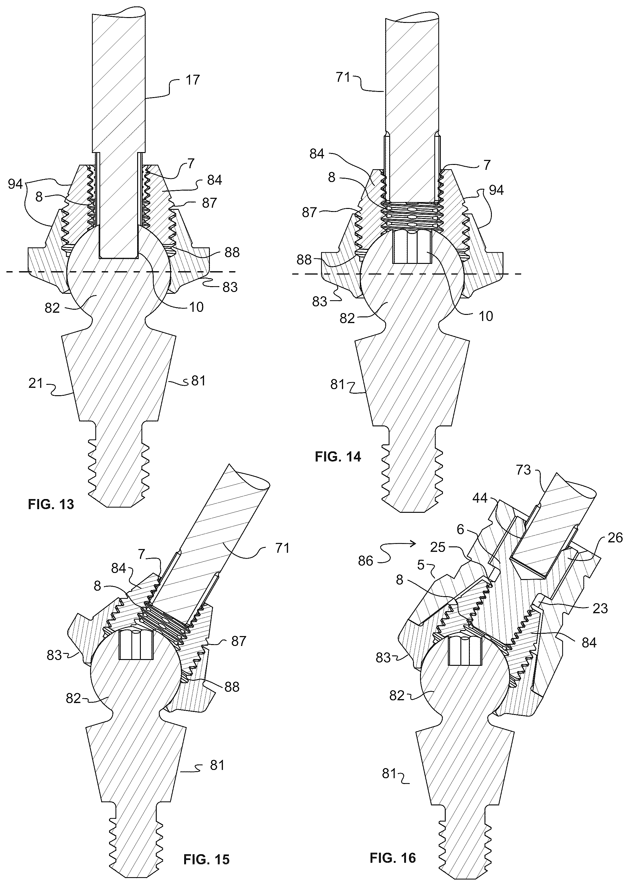 Patent US12303352 Figure 7 – Omni-directional multi-unit abutment dental systems