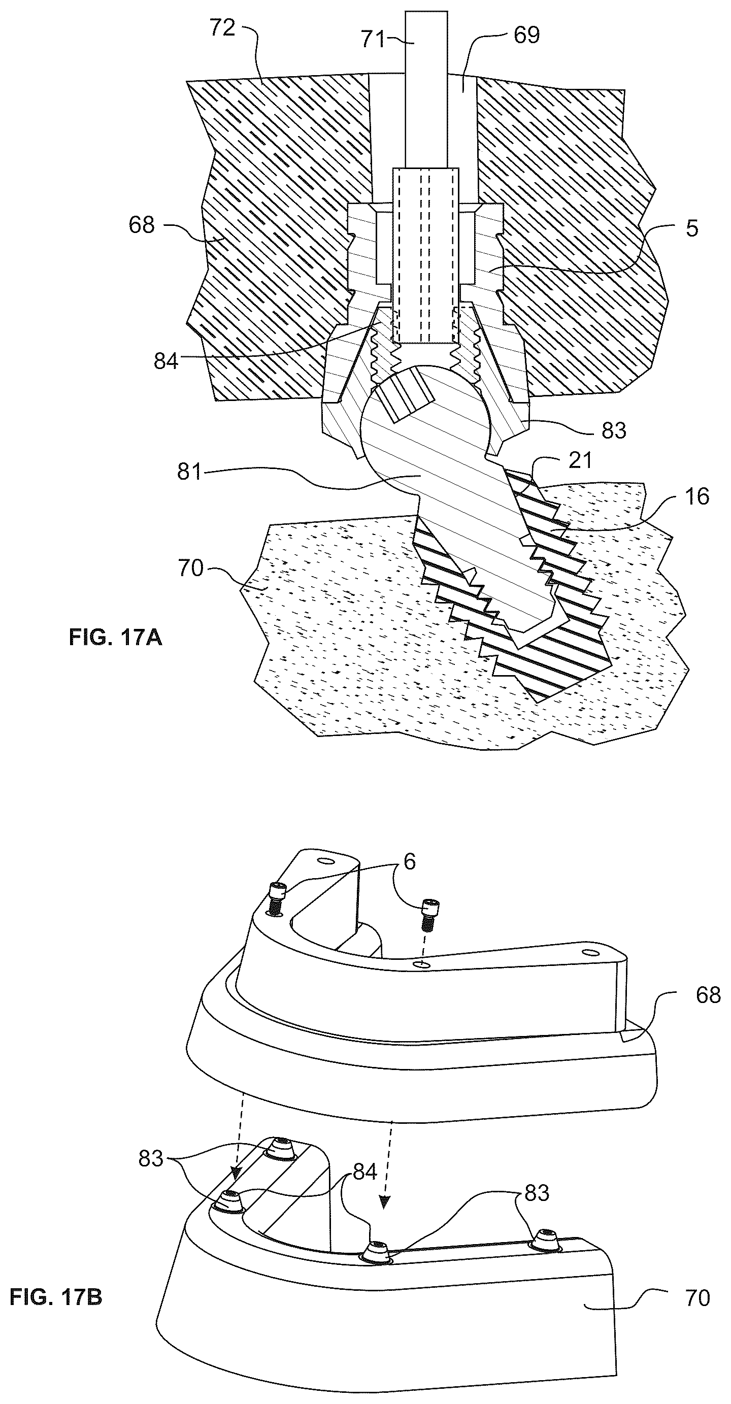 Patent US12303352 Figure 8 – Omni-directional multi-unit abutment dental systems