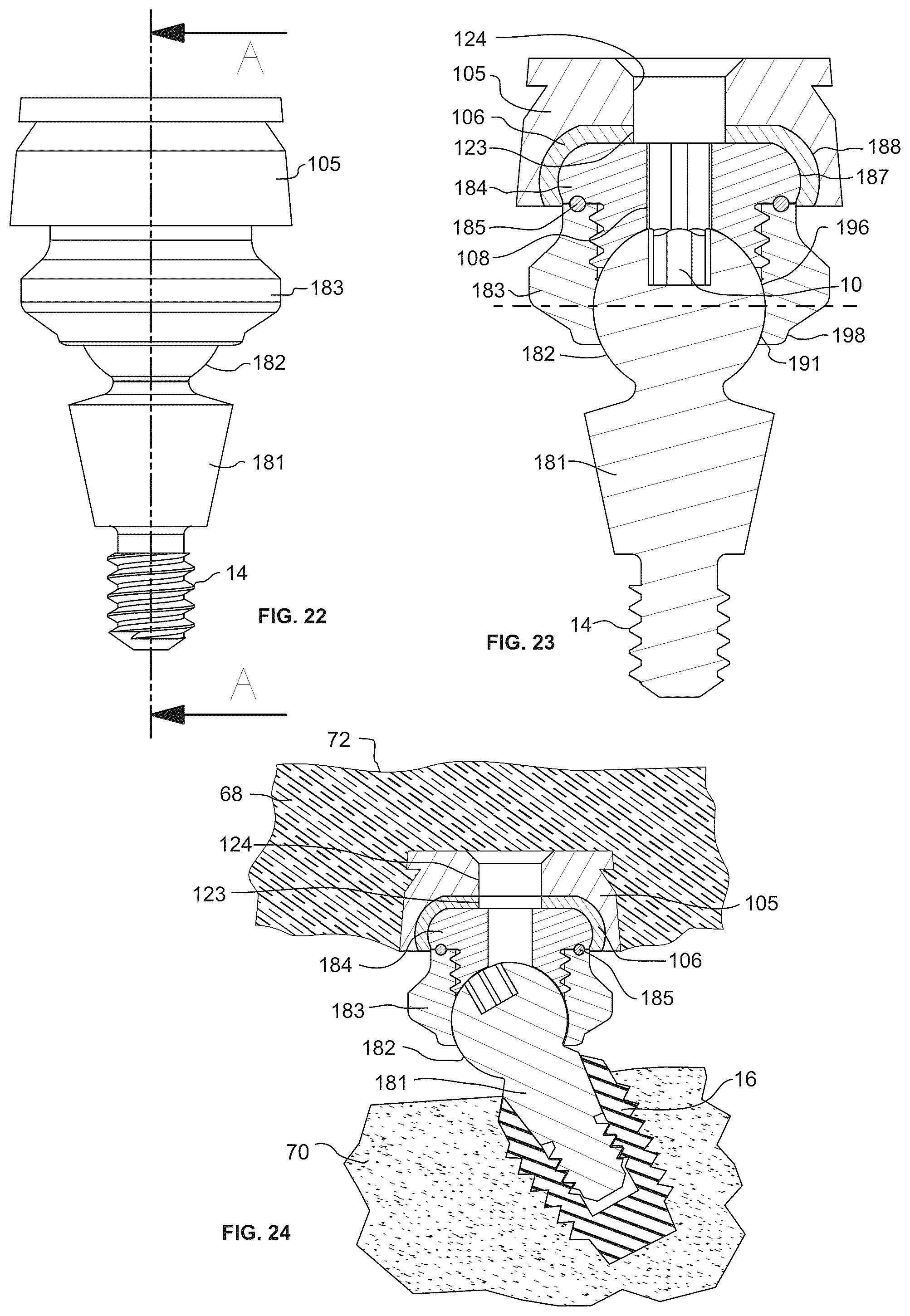 Patent US12303352 Figure 10 – Omni-directional multi-unit abutment dental systems