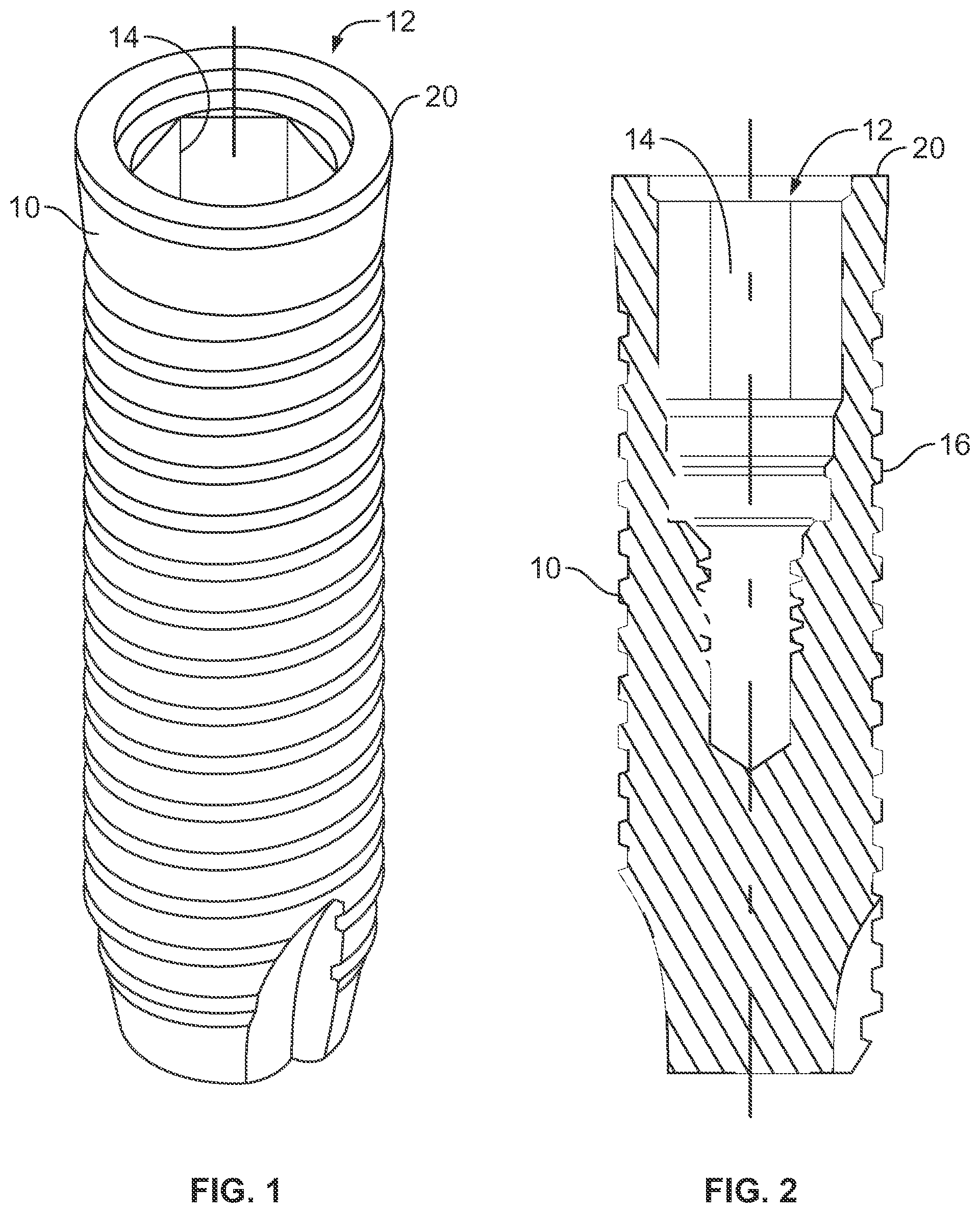 Patent US12303353 — Dental implant with coded upper surface — Figure 1