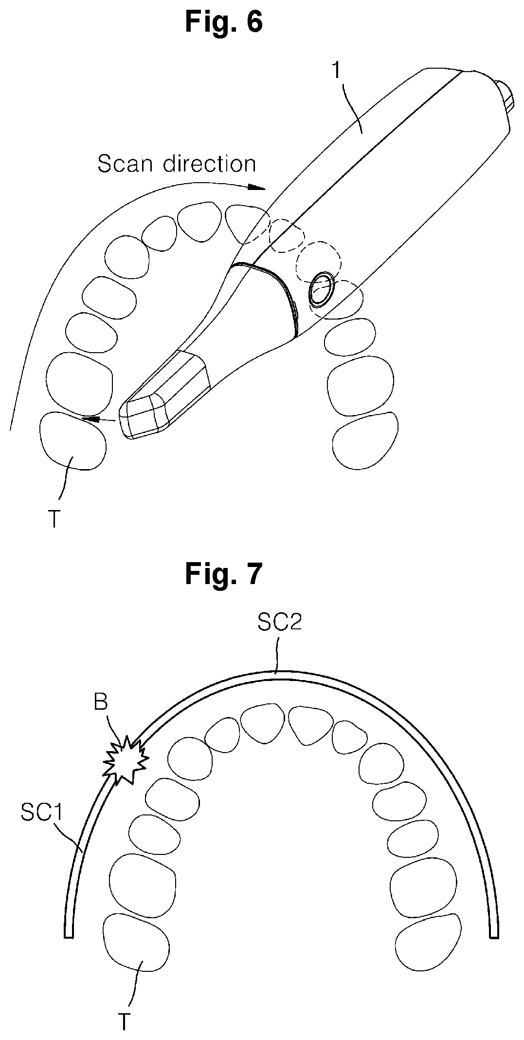 Patent US12303354 Figure 6 – Alignment state indicating apparatus and method