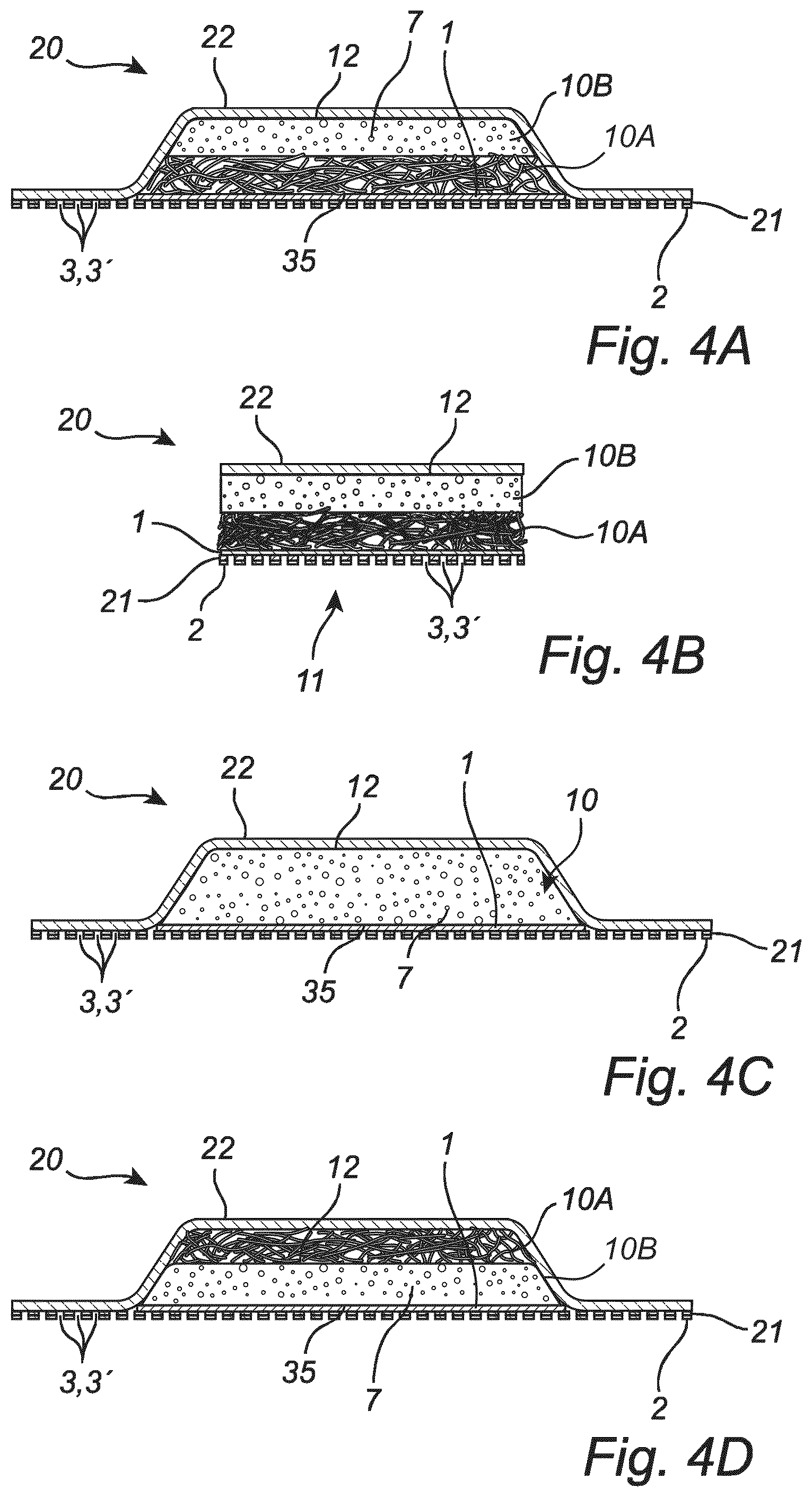 Patent US12303358 Figure 5 – Double coating for wound dressings