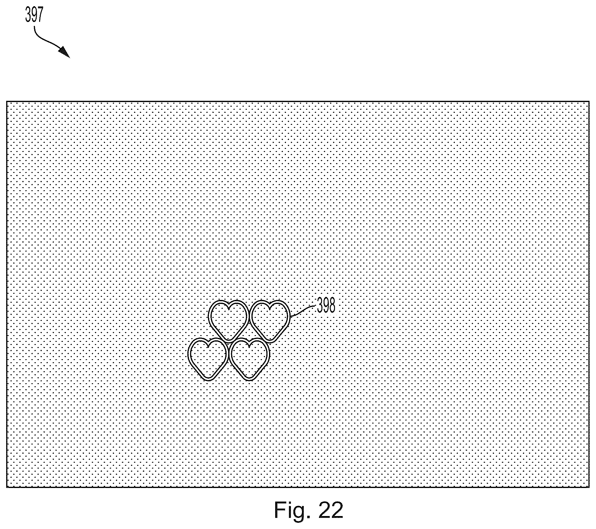 Patent US12303360 Figure 17 – Nonwoven webs with visually discernible patterns and improved texture perception