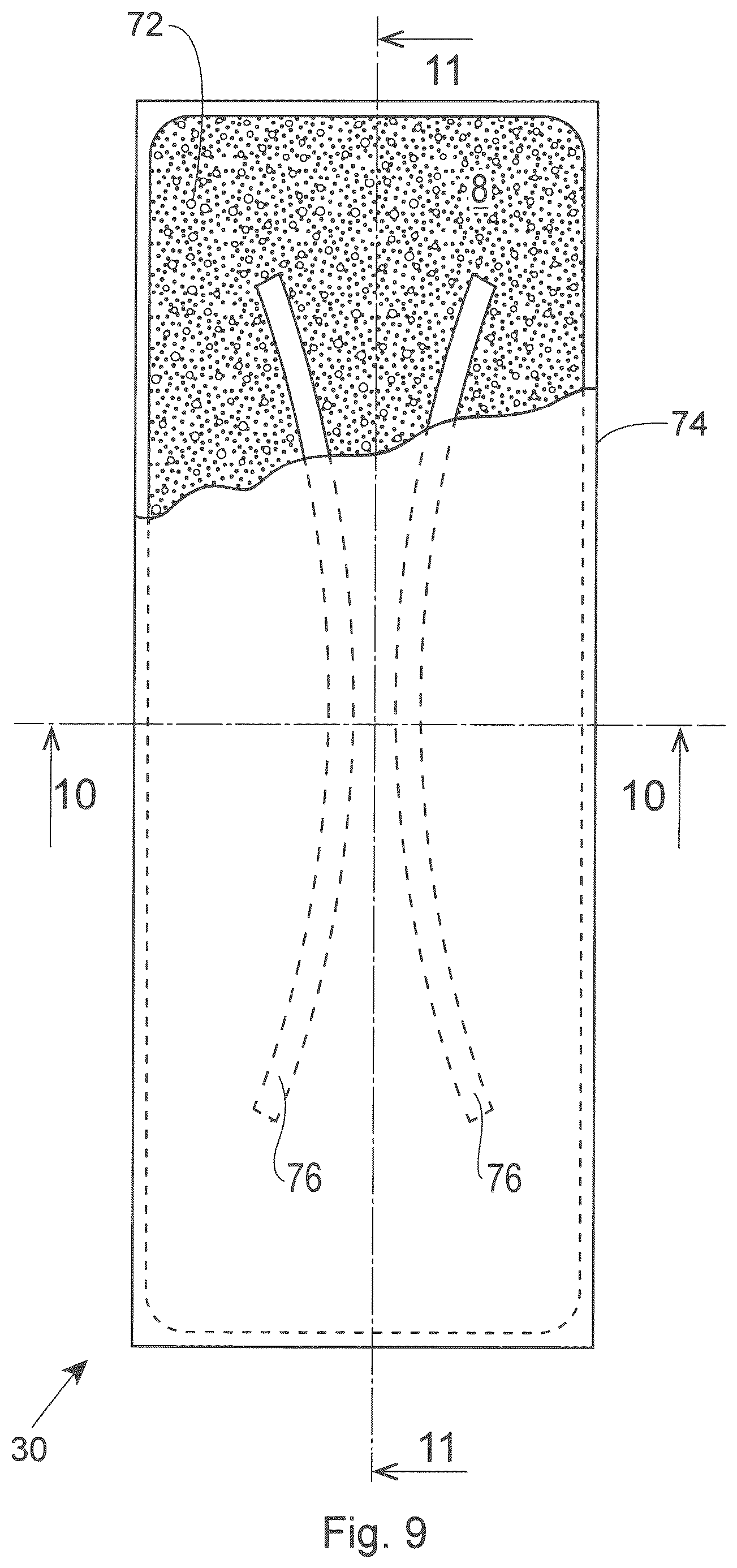 Patent US12303361 Figure 9 – Highly extensible nonwoven webs and absorbent articles having such webs