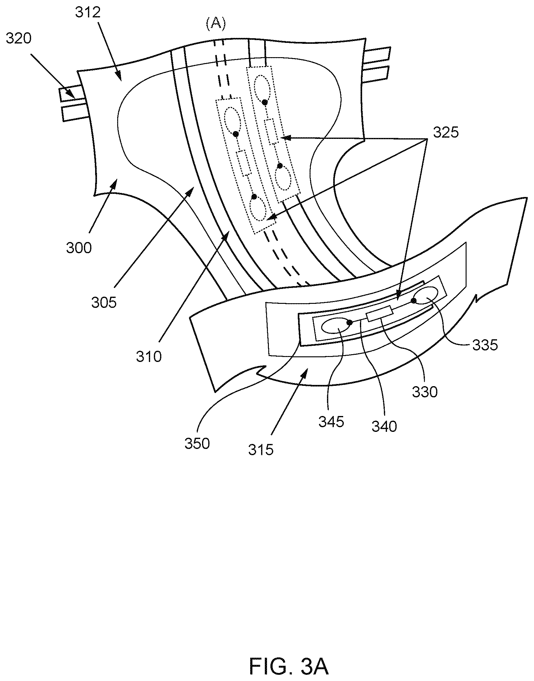 Patent US12303362 Figure 3 – Internet of things (IoT) solution for management of urinary incontinence