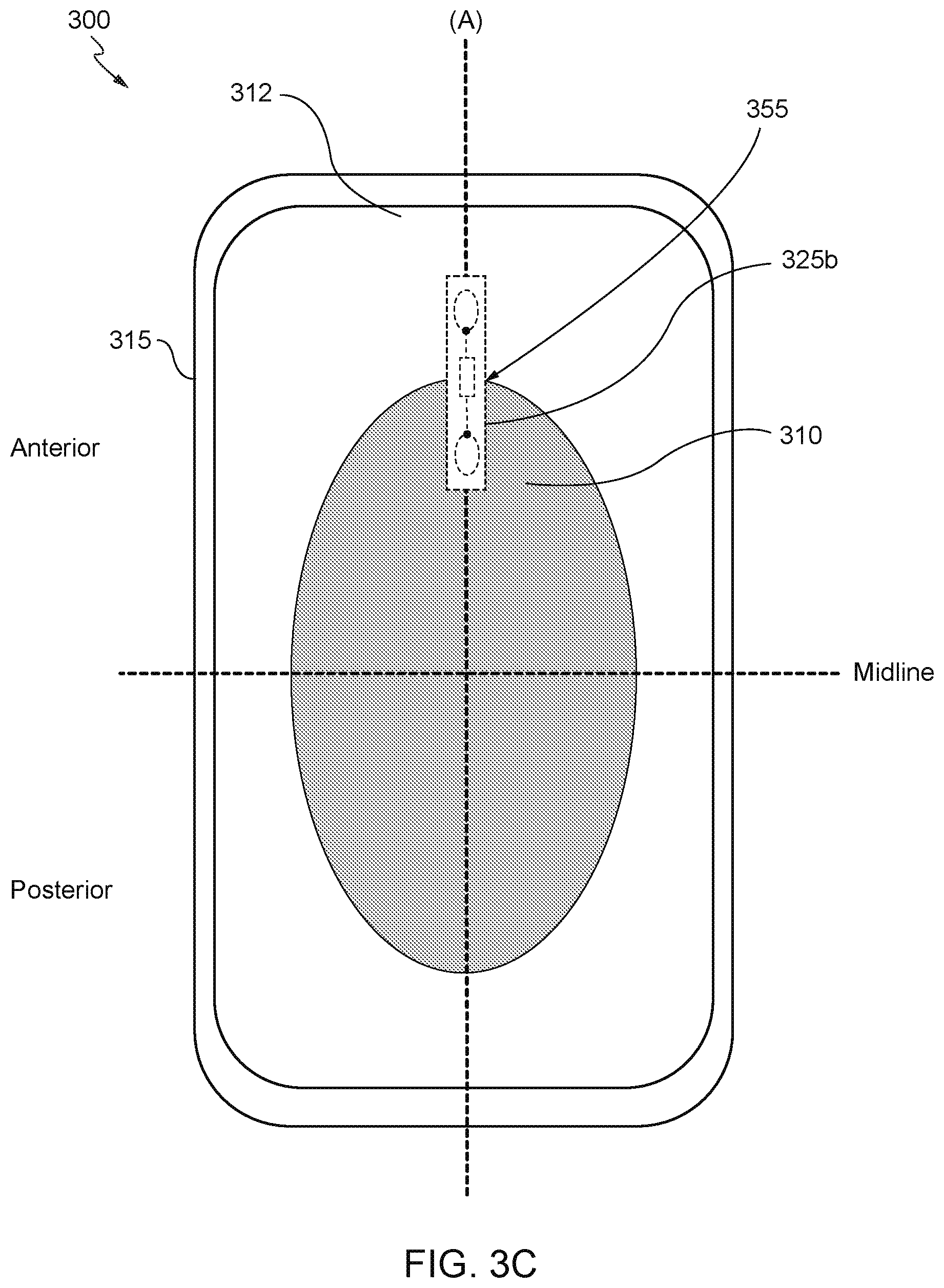 Patent US12303362 Figure 5 – Internet of things (IoT) solution for management of urinary incontinence