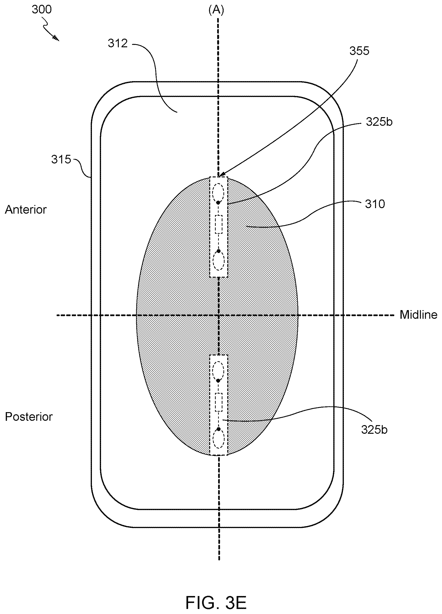 Patent US12303362 Figure 7 – Internet of things (IoT) solution for management of urinary incontinence