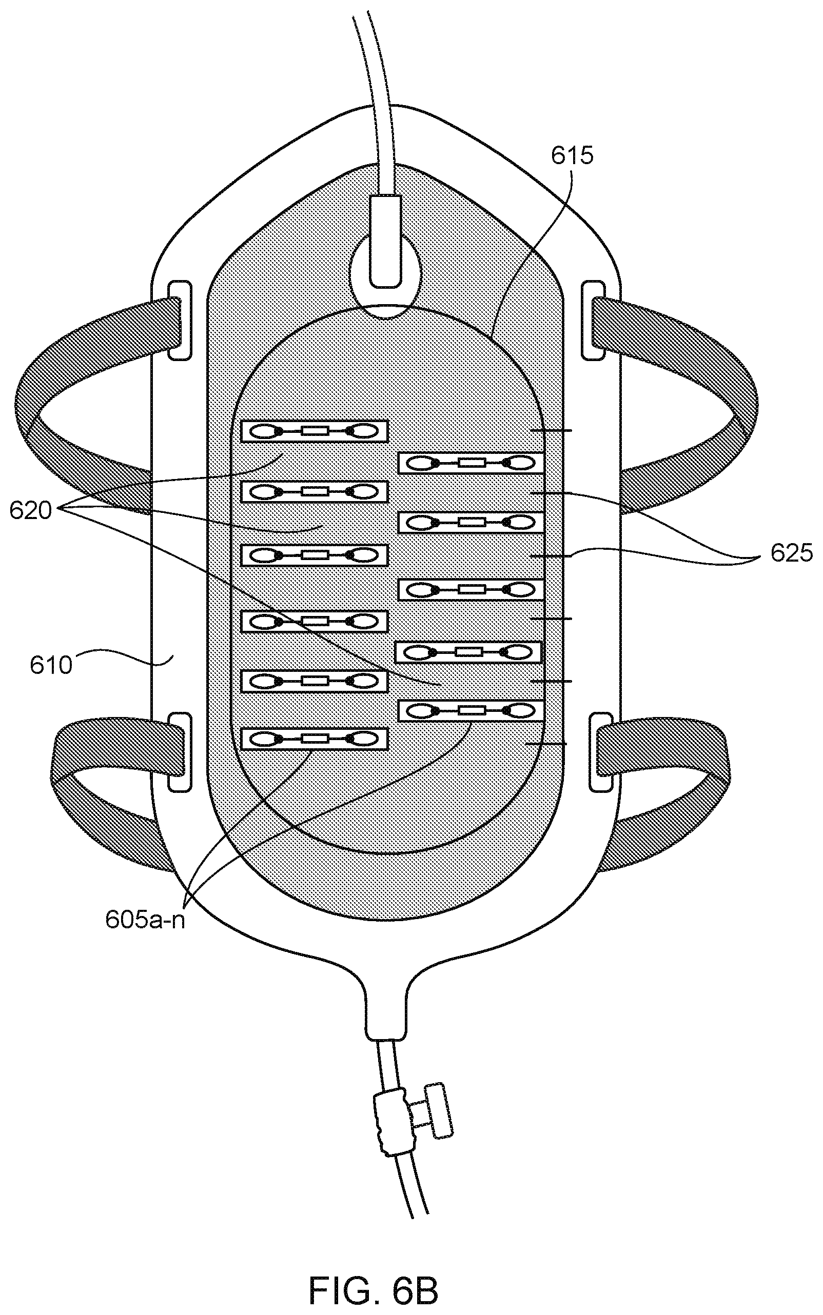 Patent US12303362 Figure 14 – Internet of things (IoT) solution for management of urinary incontinence