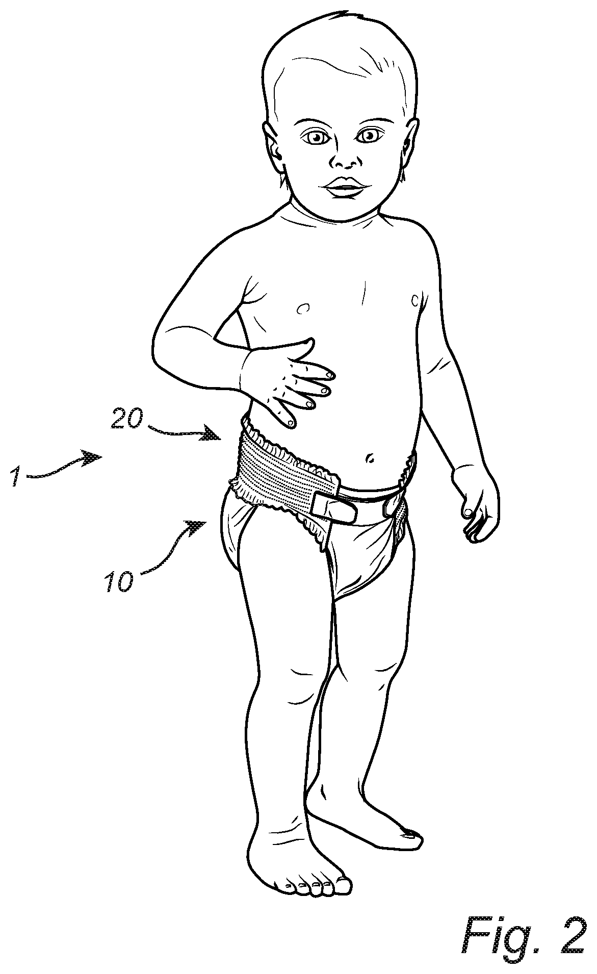 Patent US12303365 Figure 2 – Disposable absorbent hygiene article having a waist fringe region