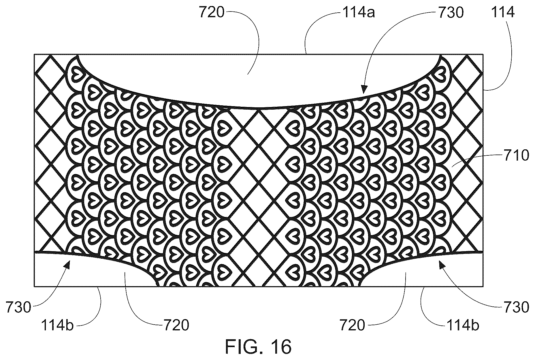 Patent US12303366 Figure 17 – Stretch laminate with beamed elastics and formed nonwoven layer