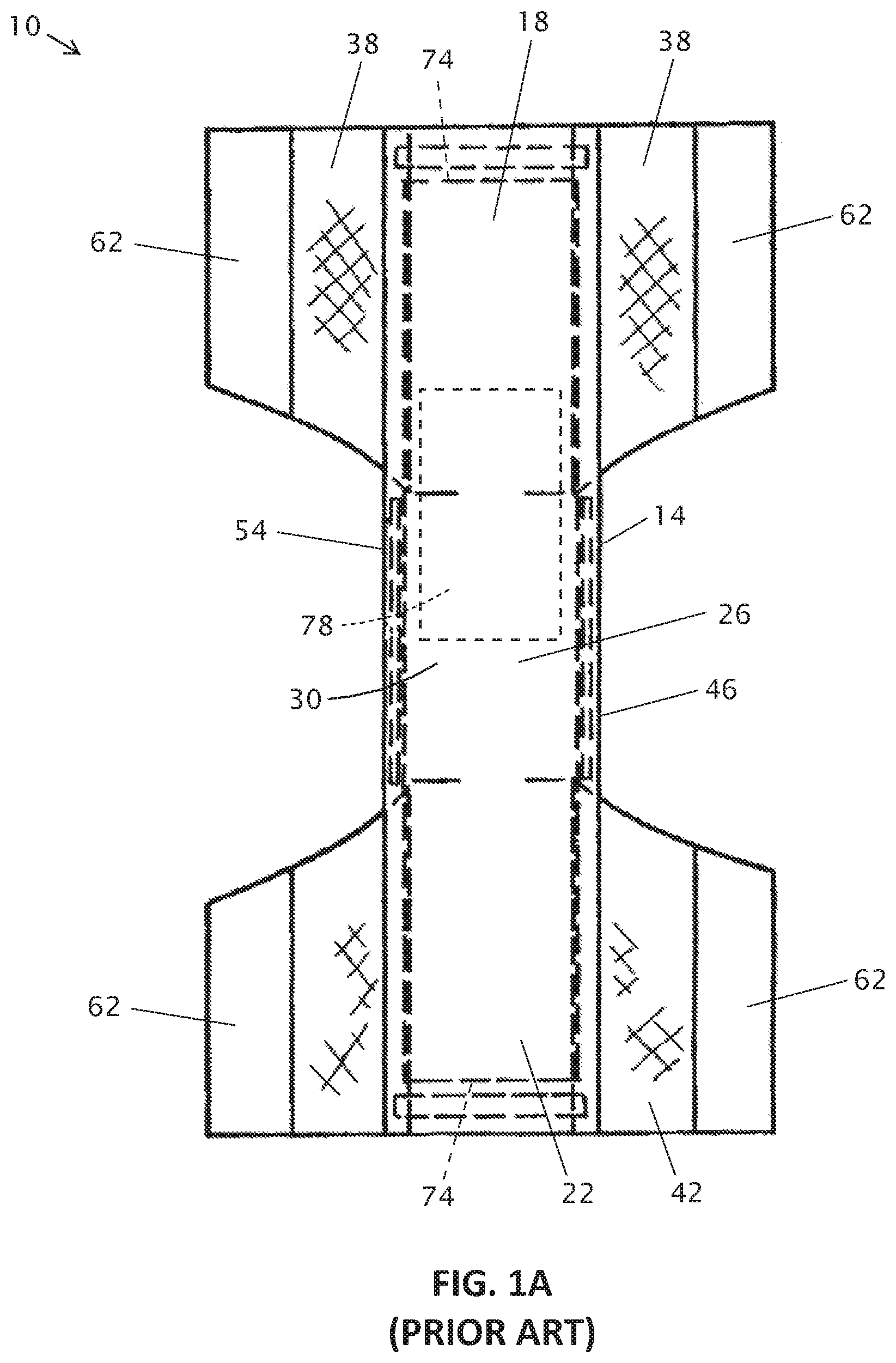 Patent US12303369 Figure 1 – Absorbent laminates, absorbent cores and disposable articles utilizing the absorbent laminates, and related methods