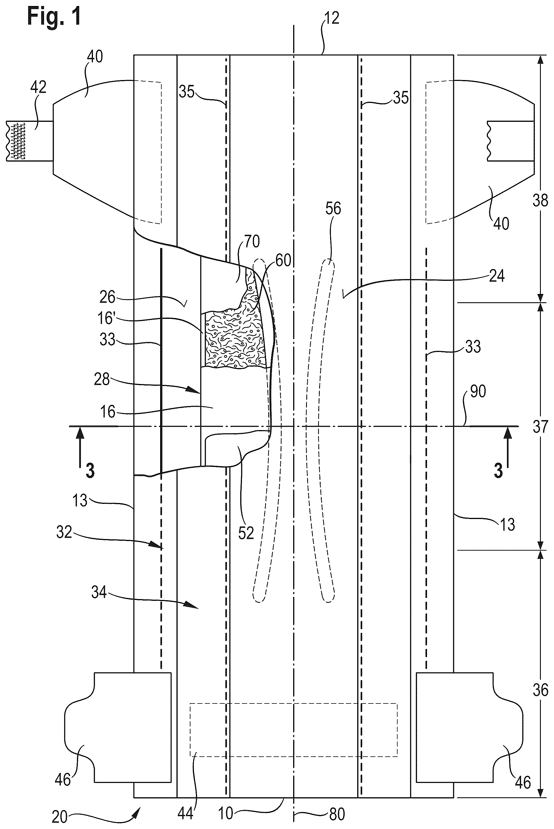 Patent US12303370 Figure 1 – Absorbent article with a channel-forming area and a masking layer