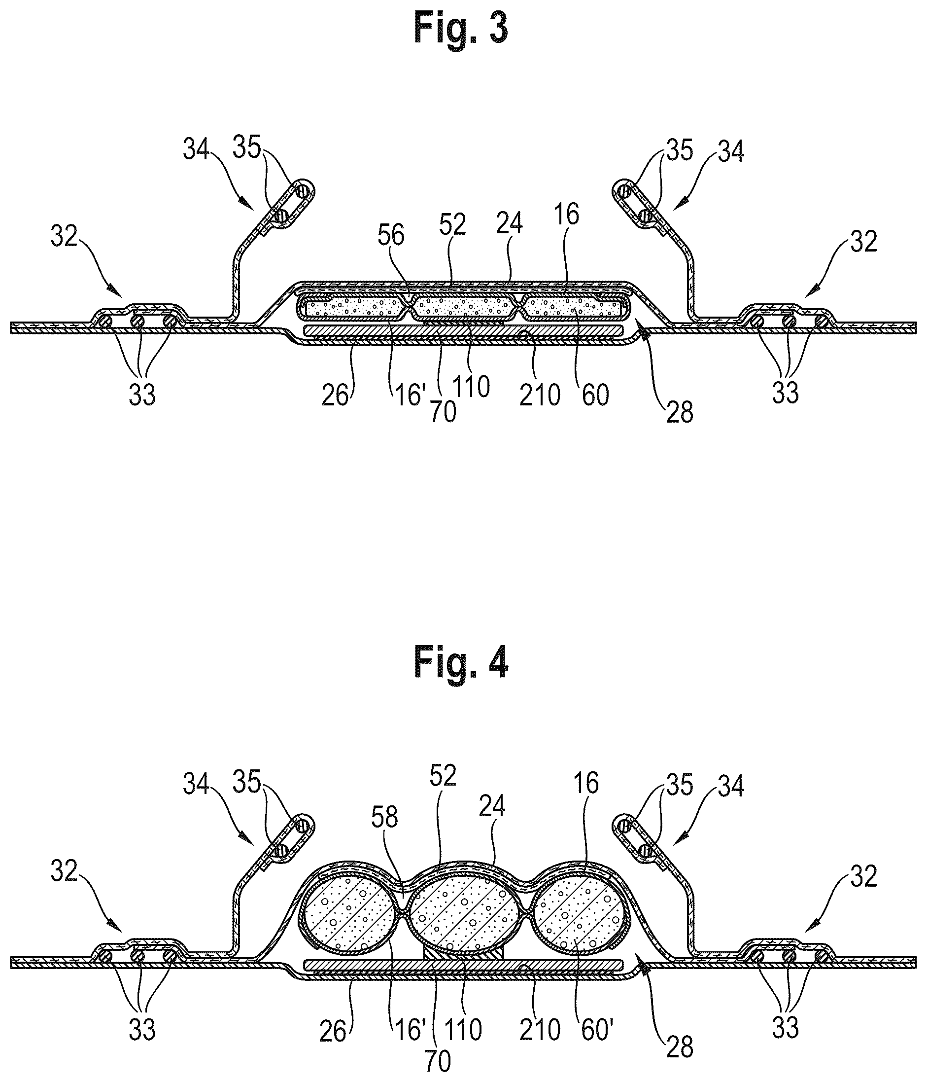 Patent US12303370 Figure 3 – Absorbent article with a channel-forming area and a masking layer
