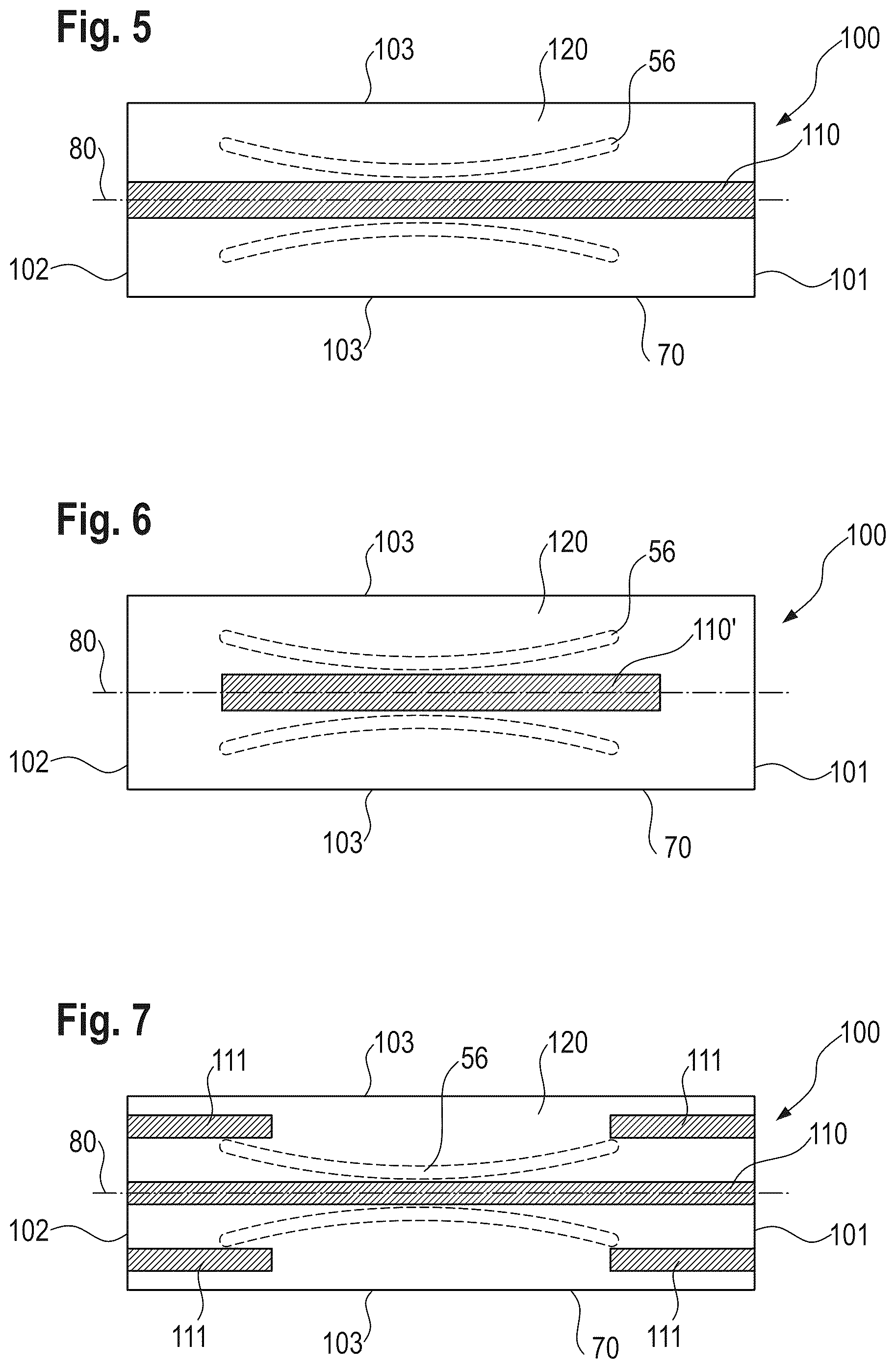 Patent US12303370 Figure 4 – Absorbent article with a channel-forming area and a masking layer