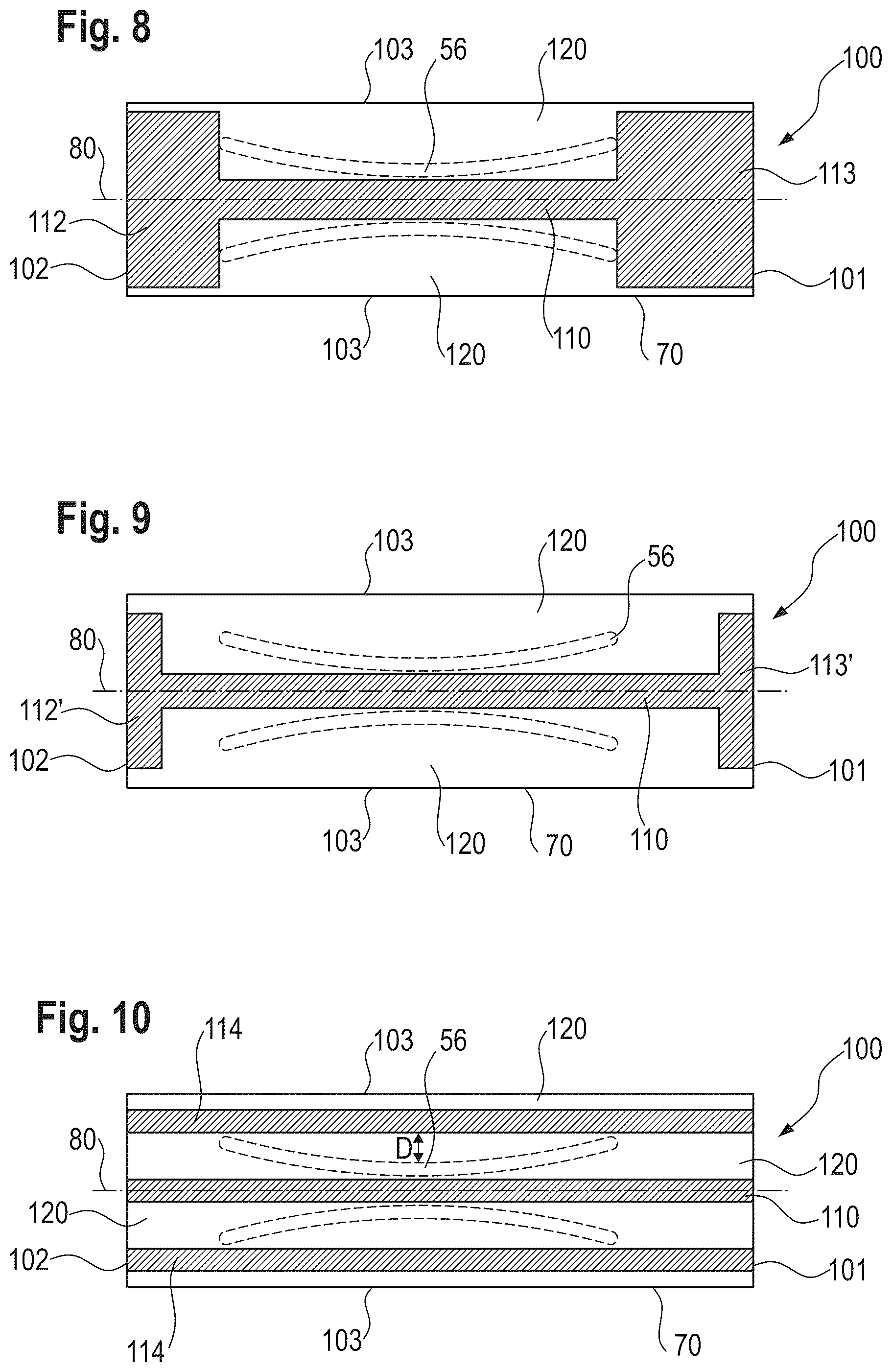 Patent US12303370 Figure 5 – Absorbent article with a channel-forming area and a masking layer