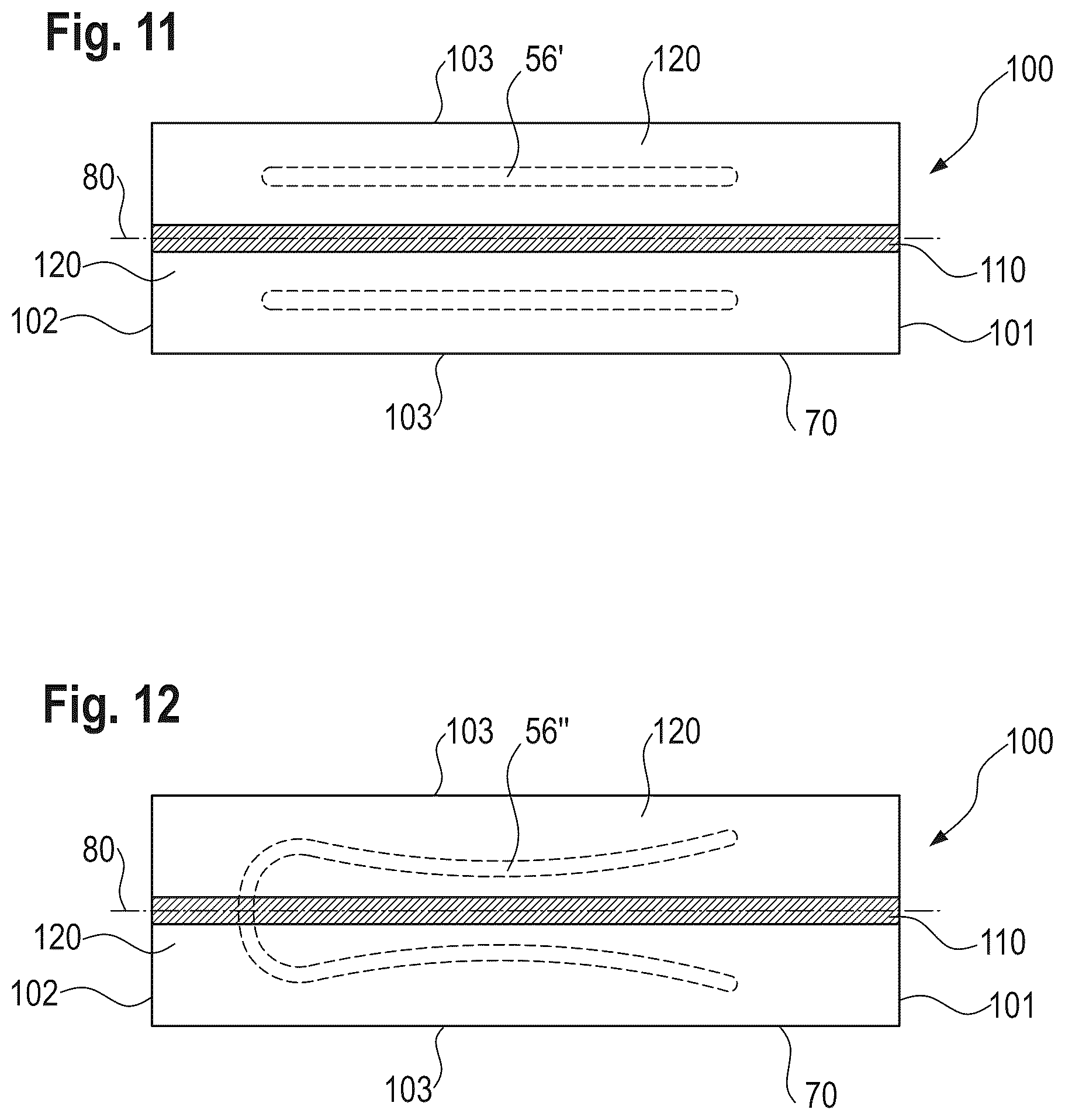 Patent US12303370 Figure 6 – Absorbent article with a channel-forming area and a masking layer
