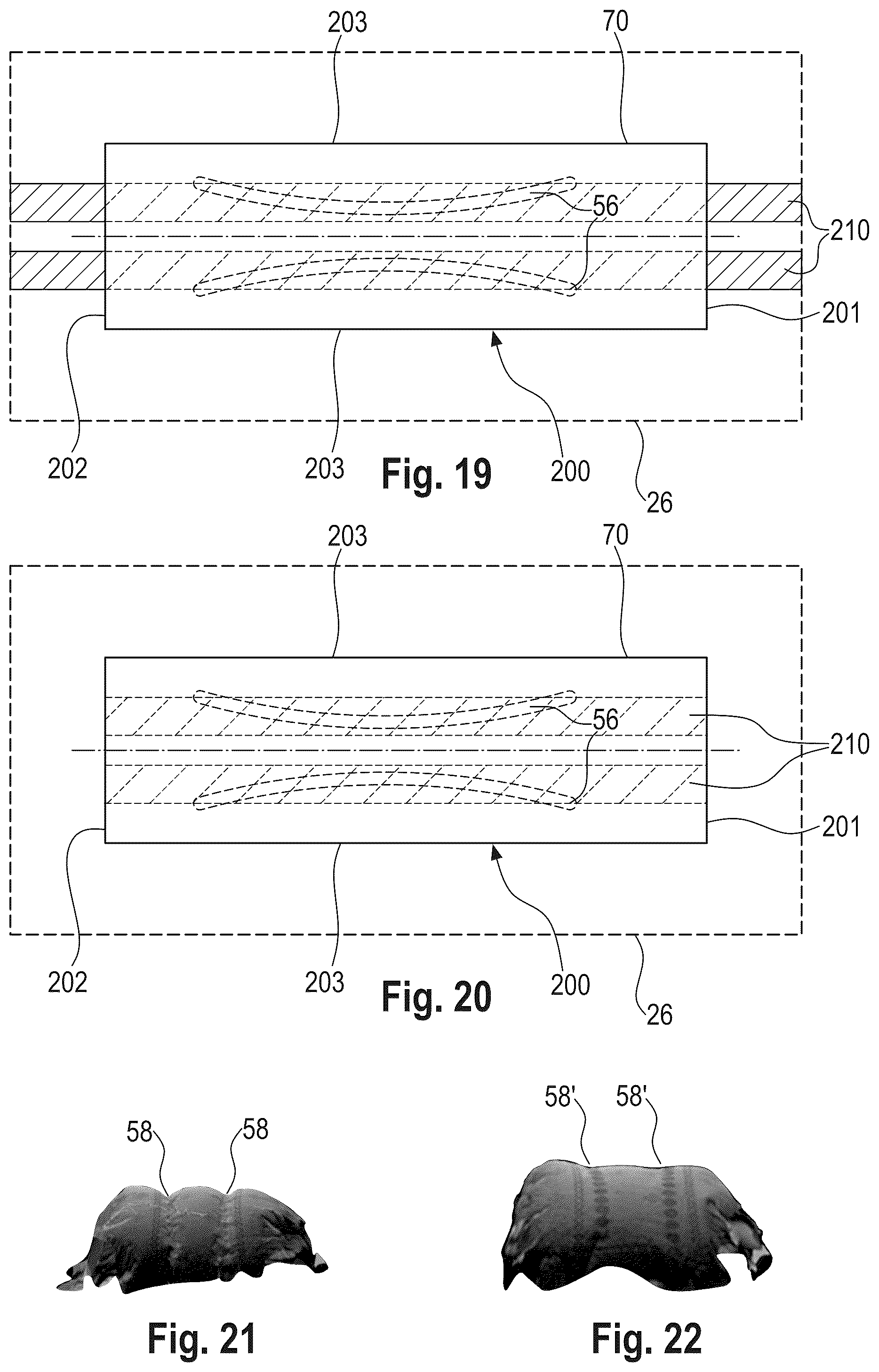 Patent US12303370 Figure 10 – Absorbent article with a channel-forming area and a masking layer