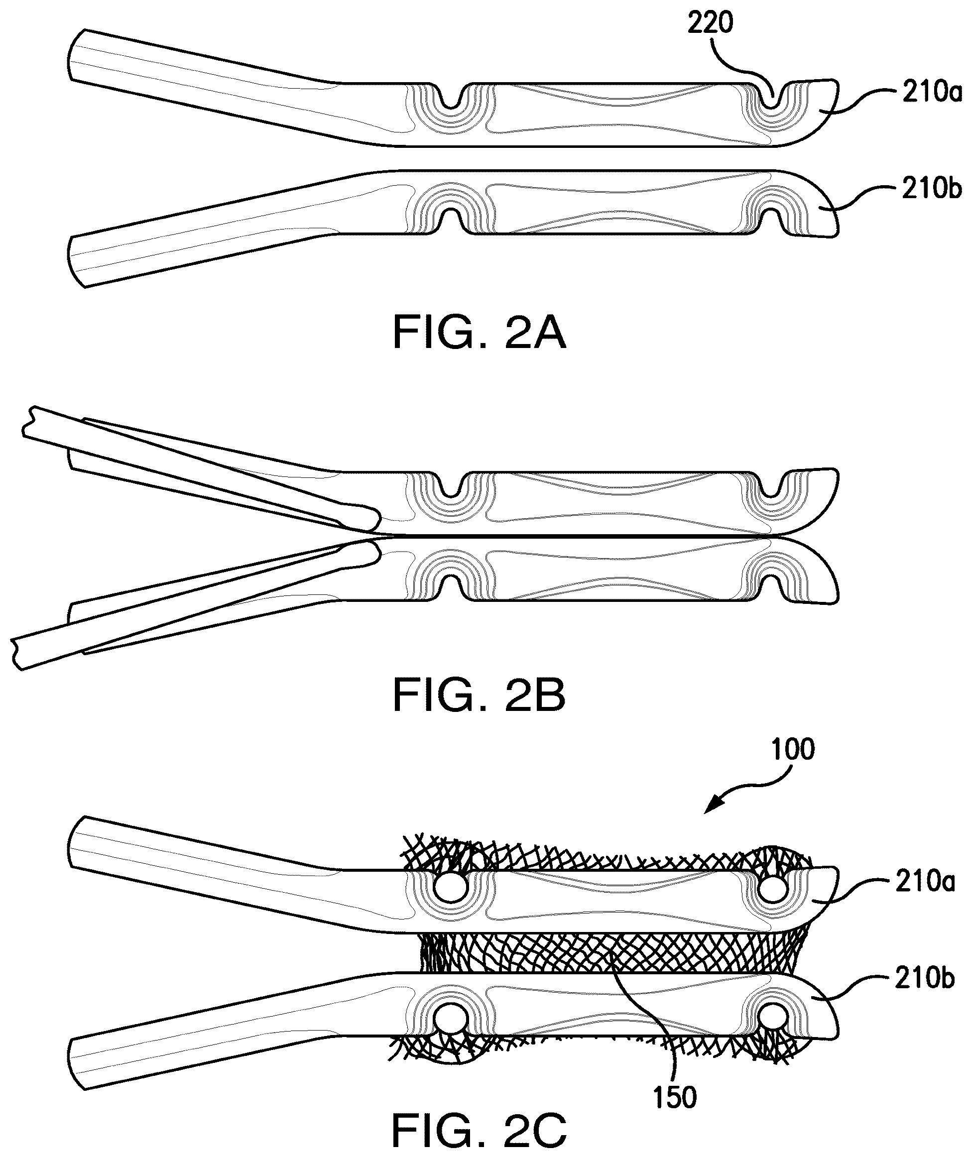 Patent US12303373 Figure 3 – Systems and methods for mesh augmentation and prevention of incisional hernia
