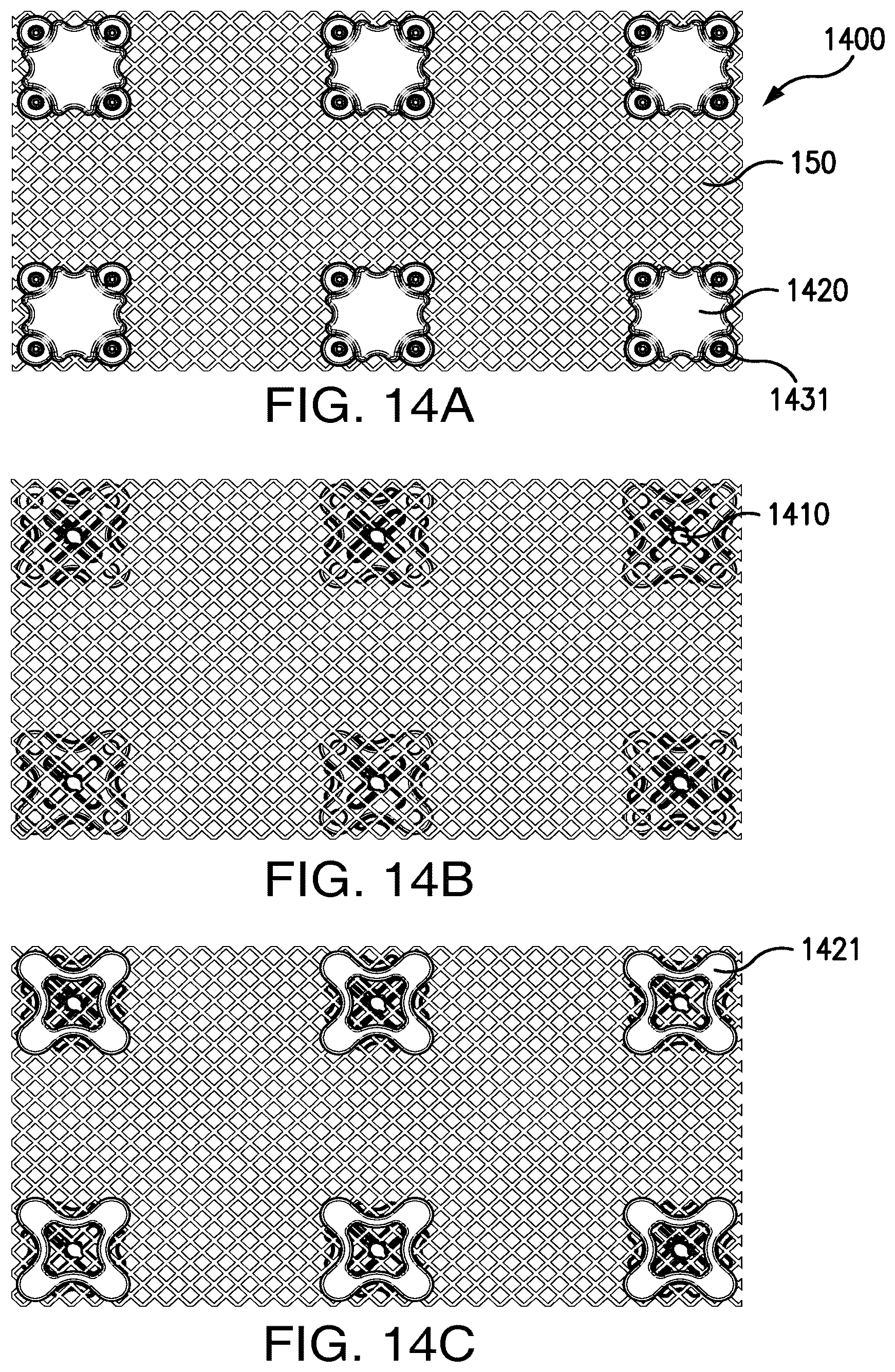 Patent US12303373 Figure 14 – Systems and methods for mesh augmentation and prevention of incisional hernia