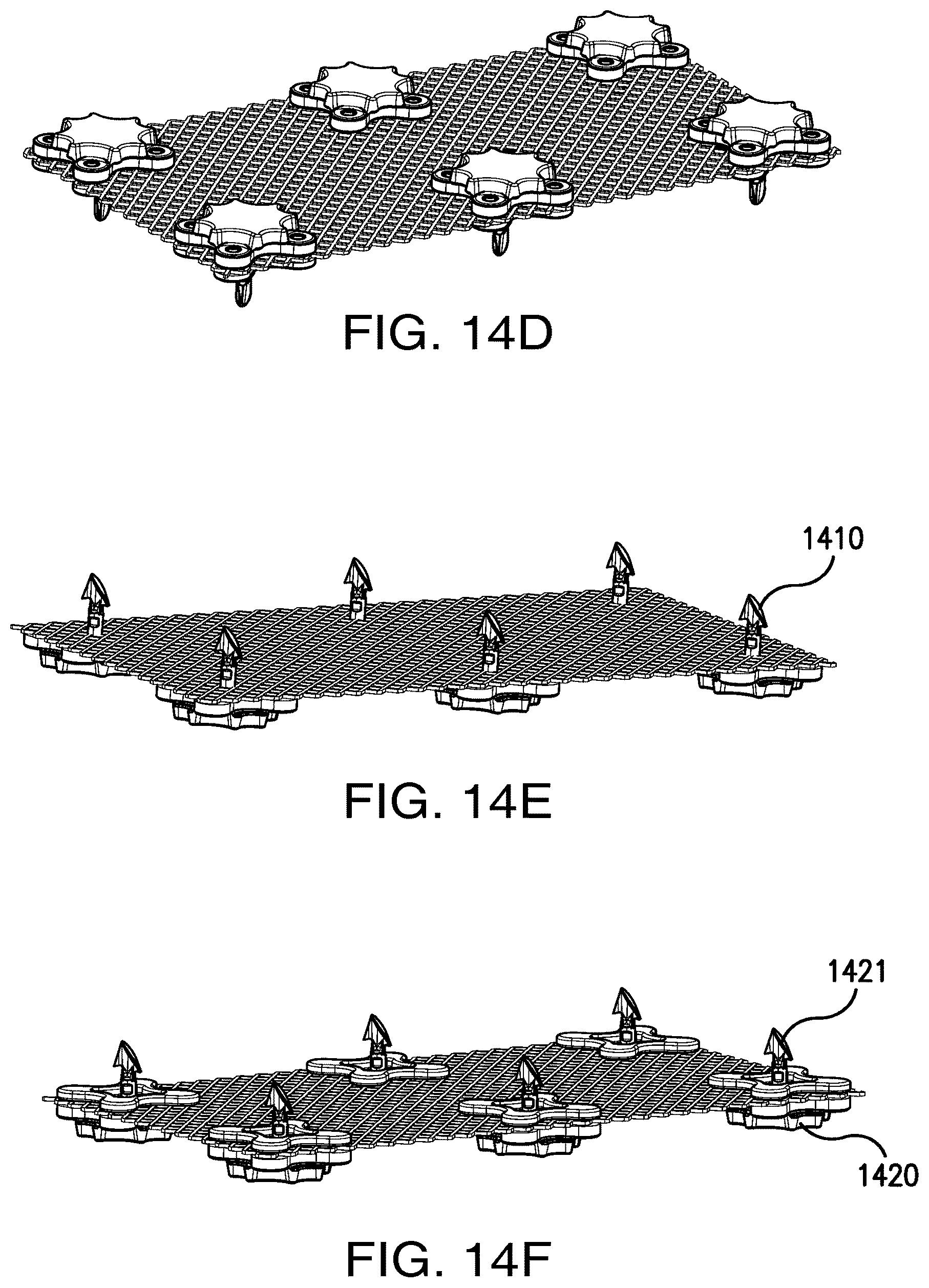 Patent US12303373 Figure 15 – Systems and methods for mesh augmentation and prevention of incisional hernia