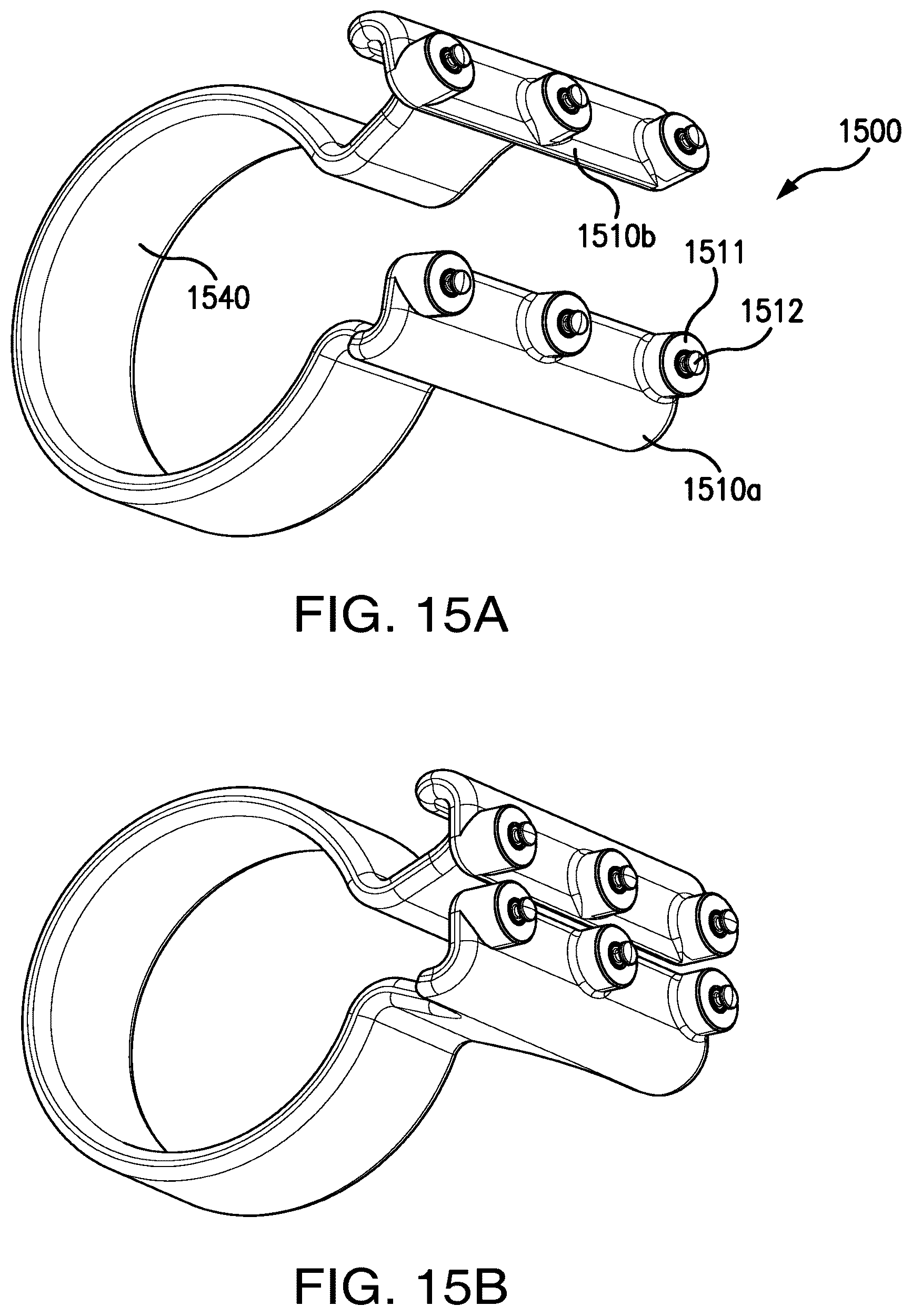 Patent US12303373 Figure 16 – Systems and methods for mesh augmentation and prevention of incisional hernia