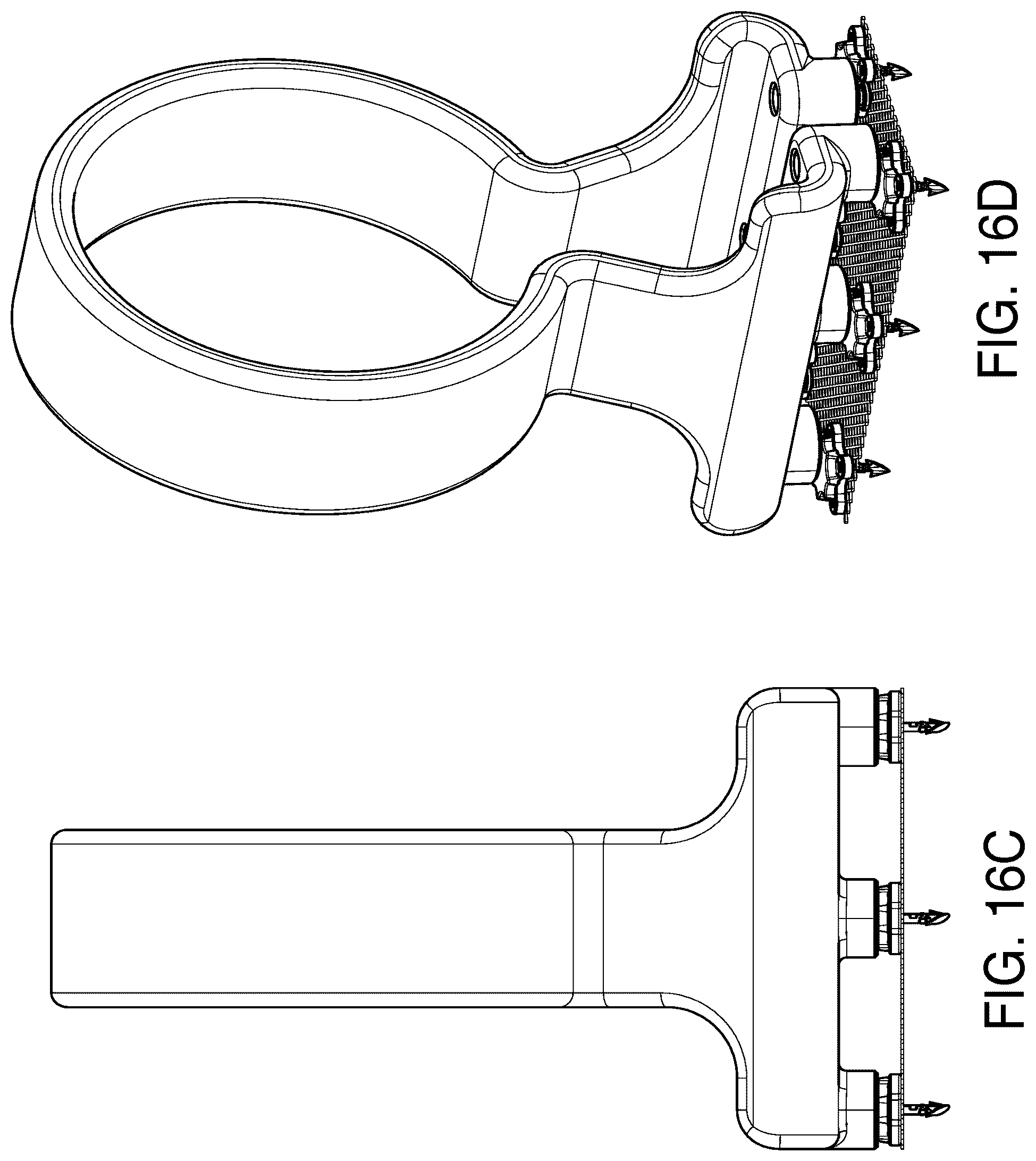 Patent US12303373 Figure 18 – Systems and methods for mesh augmentation and prevention of incisional hernia