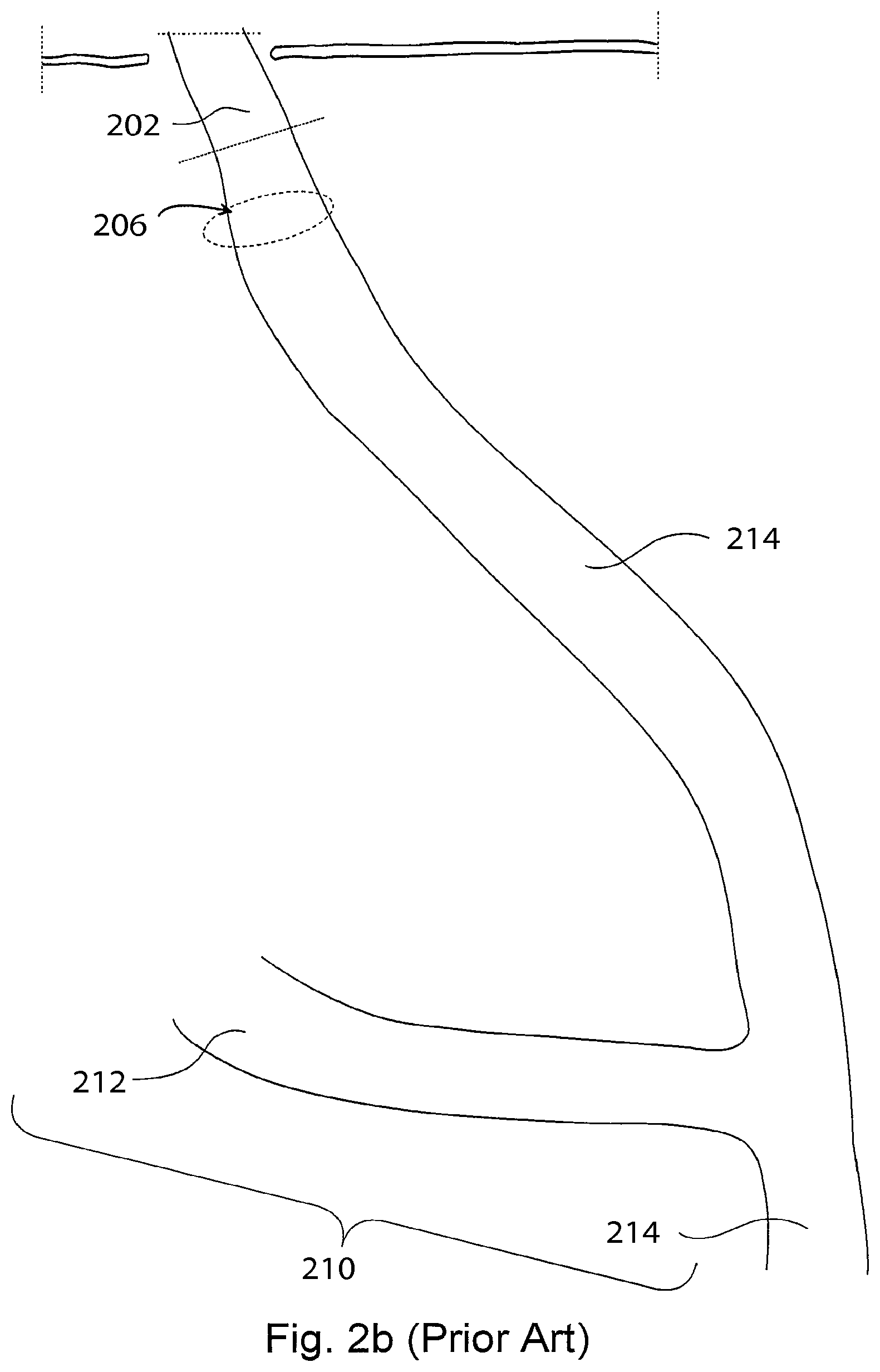 Patent US12303375 Figure 3 – Artificial stomach