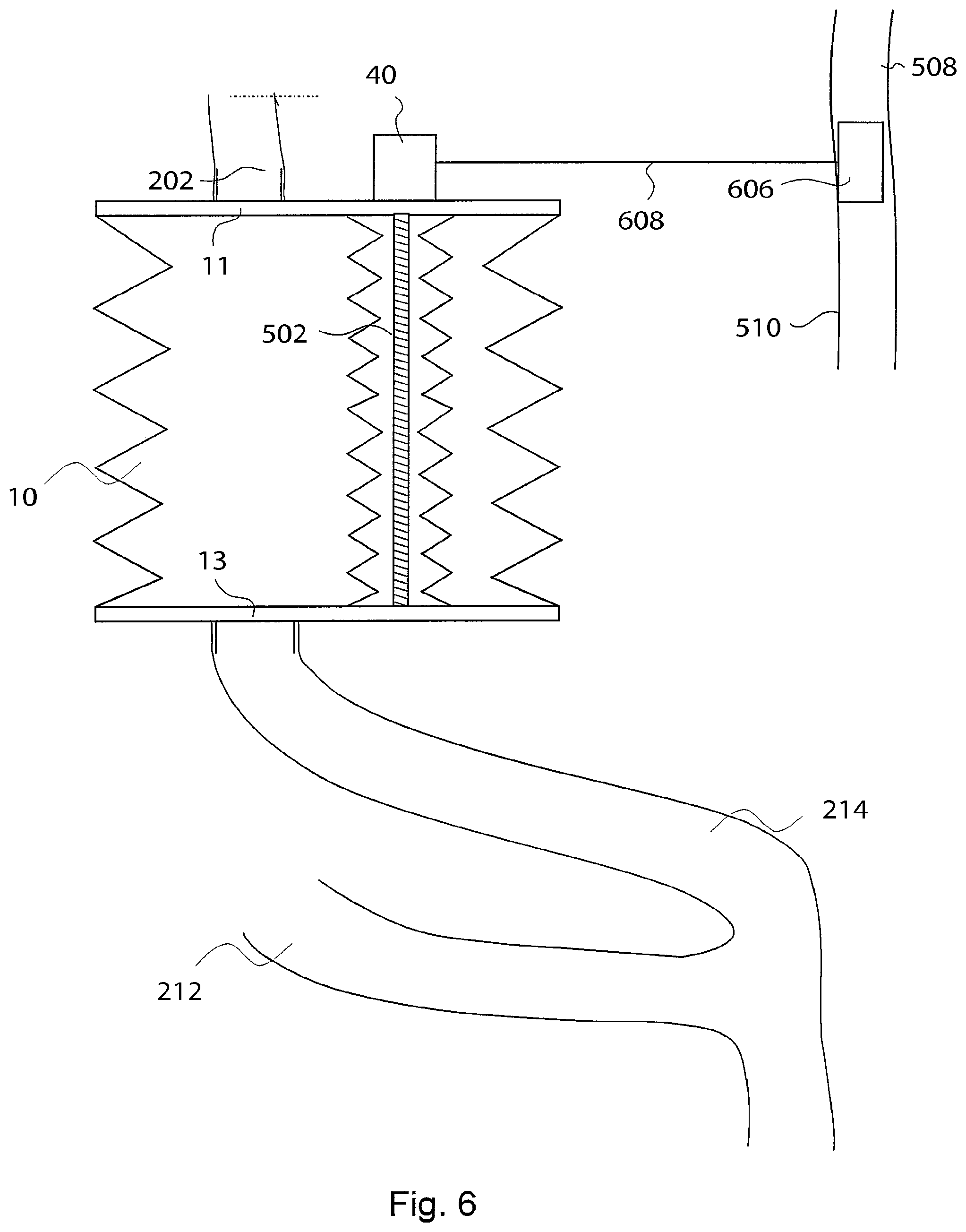 Patent US12303375 Figure 7 – Artificial stomach