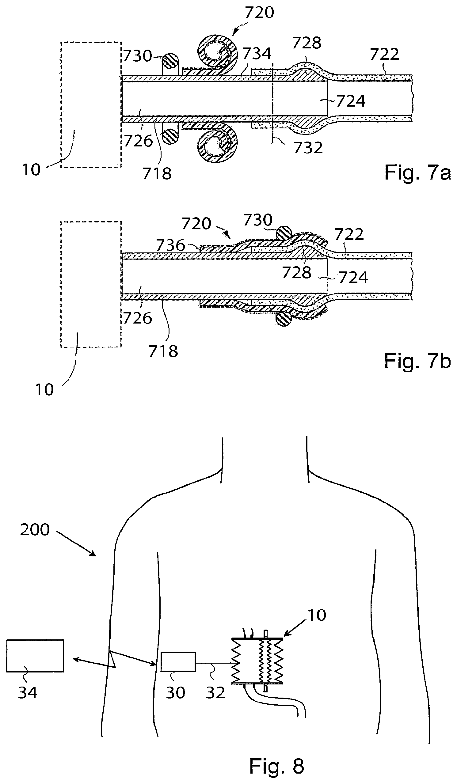 Patent US12303375 Figure 8 – Artificial stomach