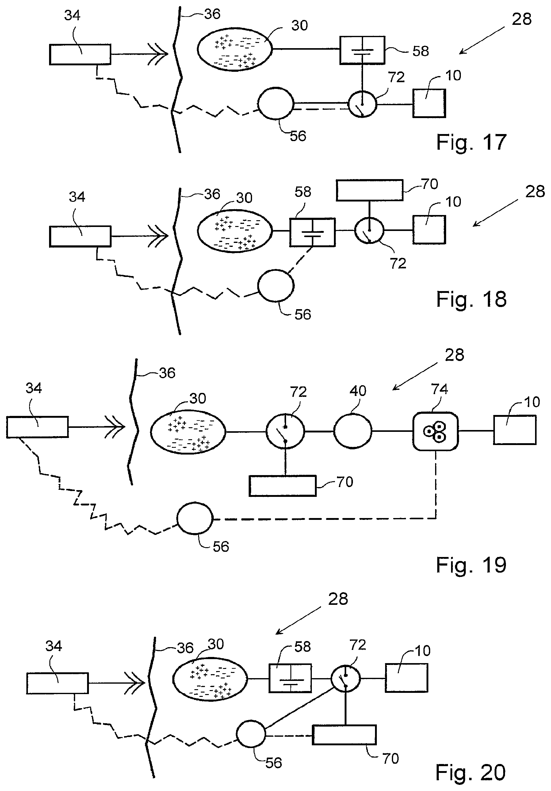 Patent US12303375 Figure 11 – Artificial stomach