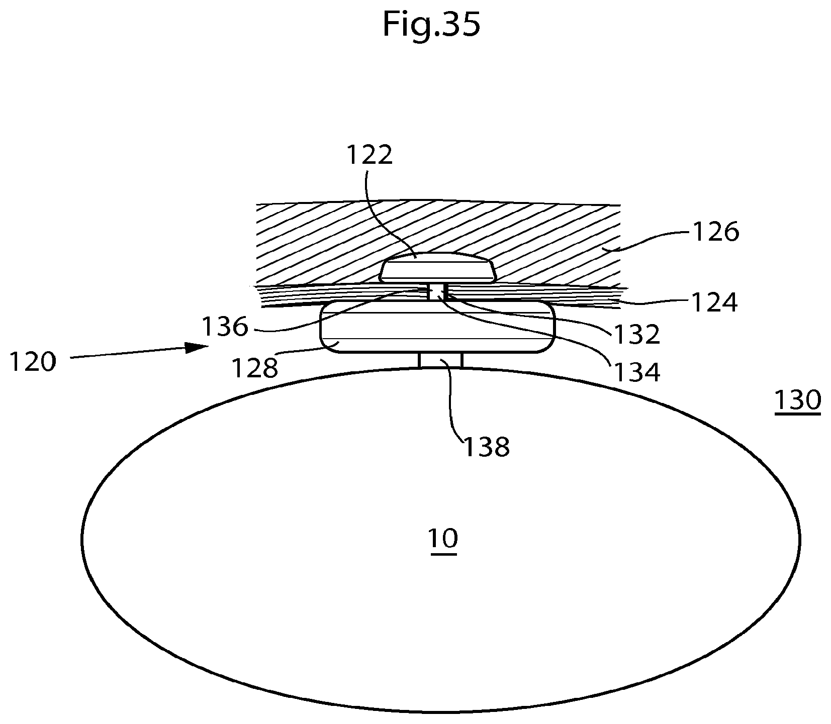 Patent US12303375 Figure 19 – Artificial stomach