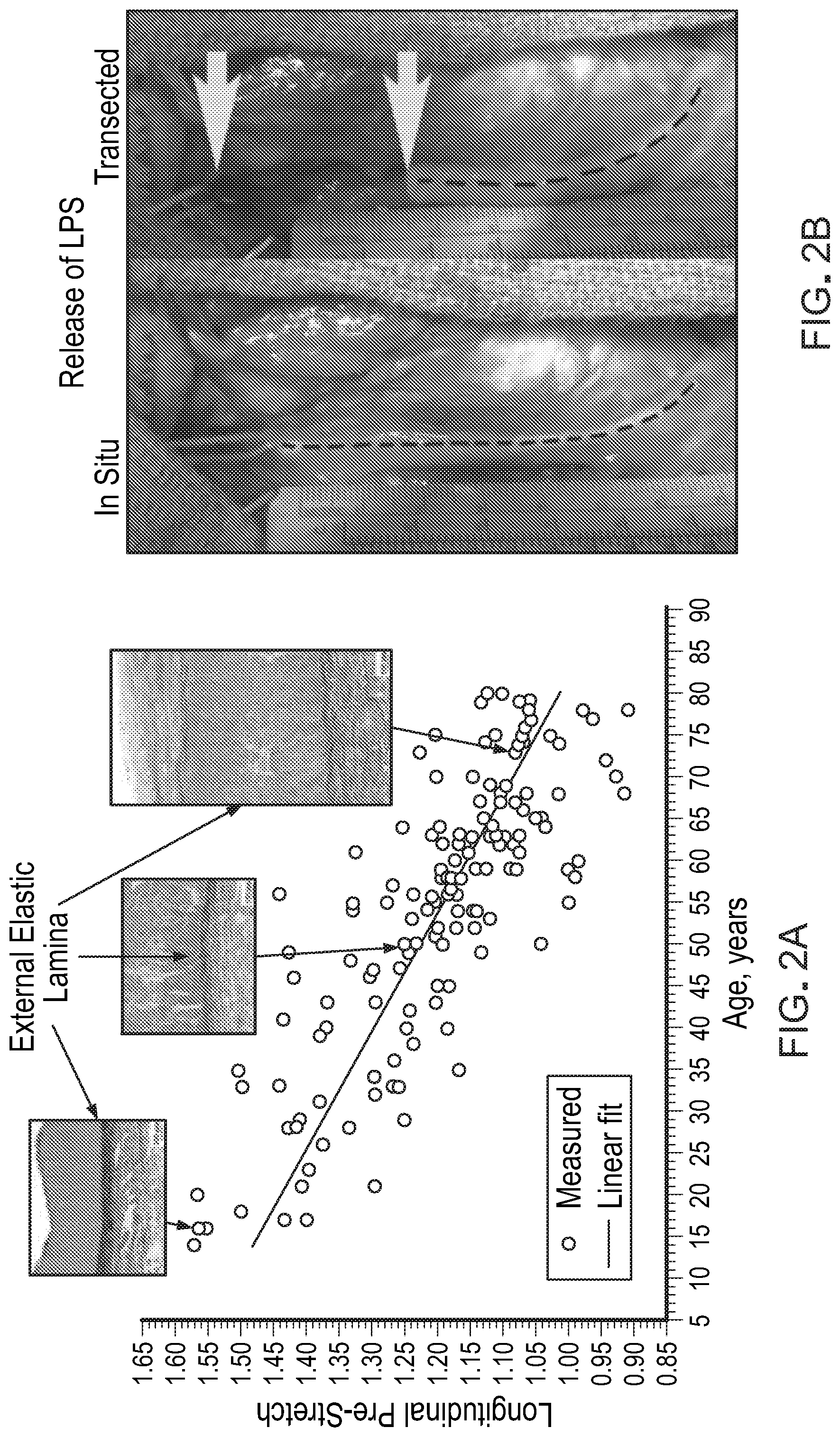 Patent US12303376 Figure 2 – Bypass graft
