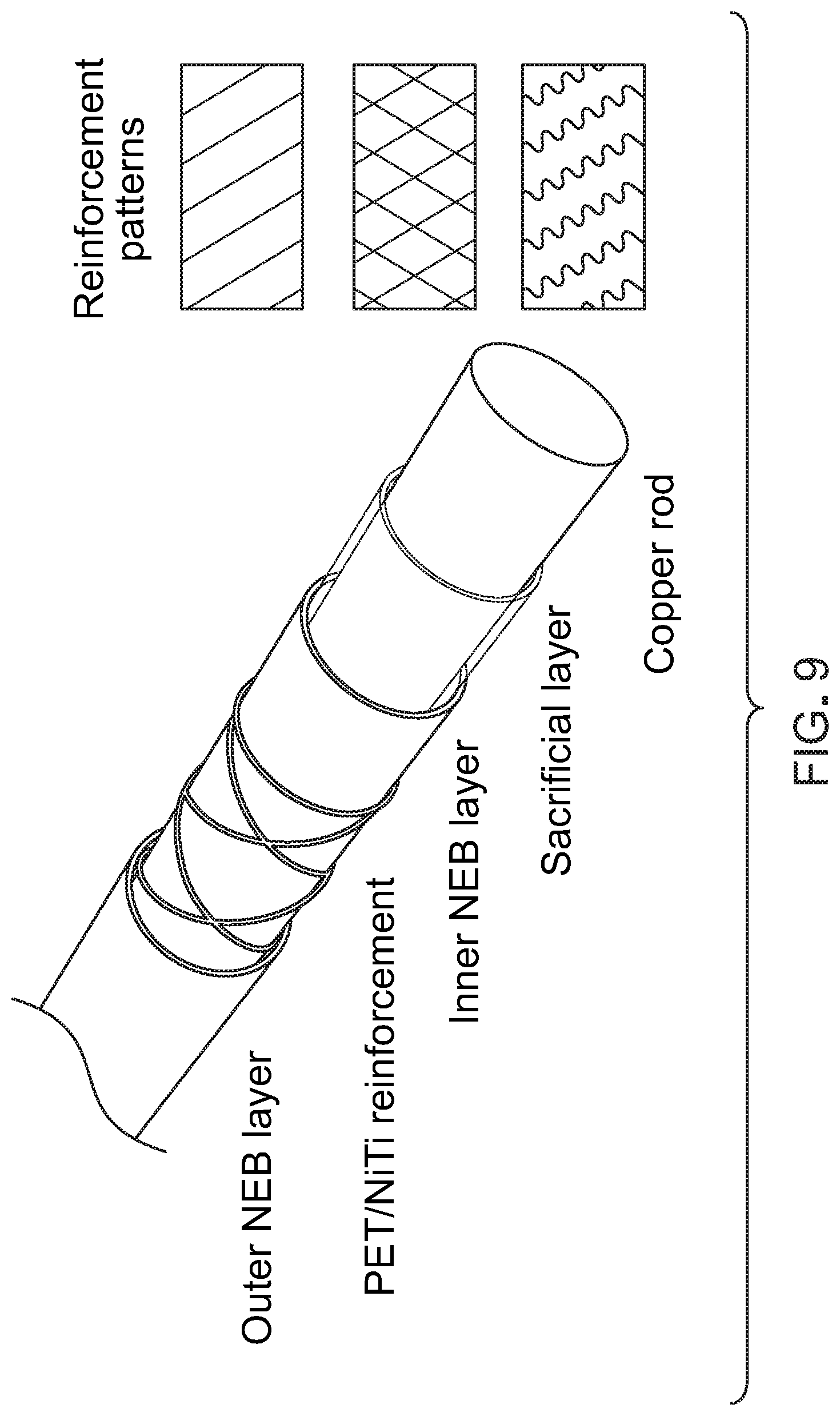Patent US12303376 Figure 10 – Bypass graft