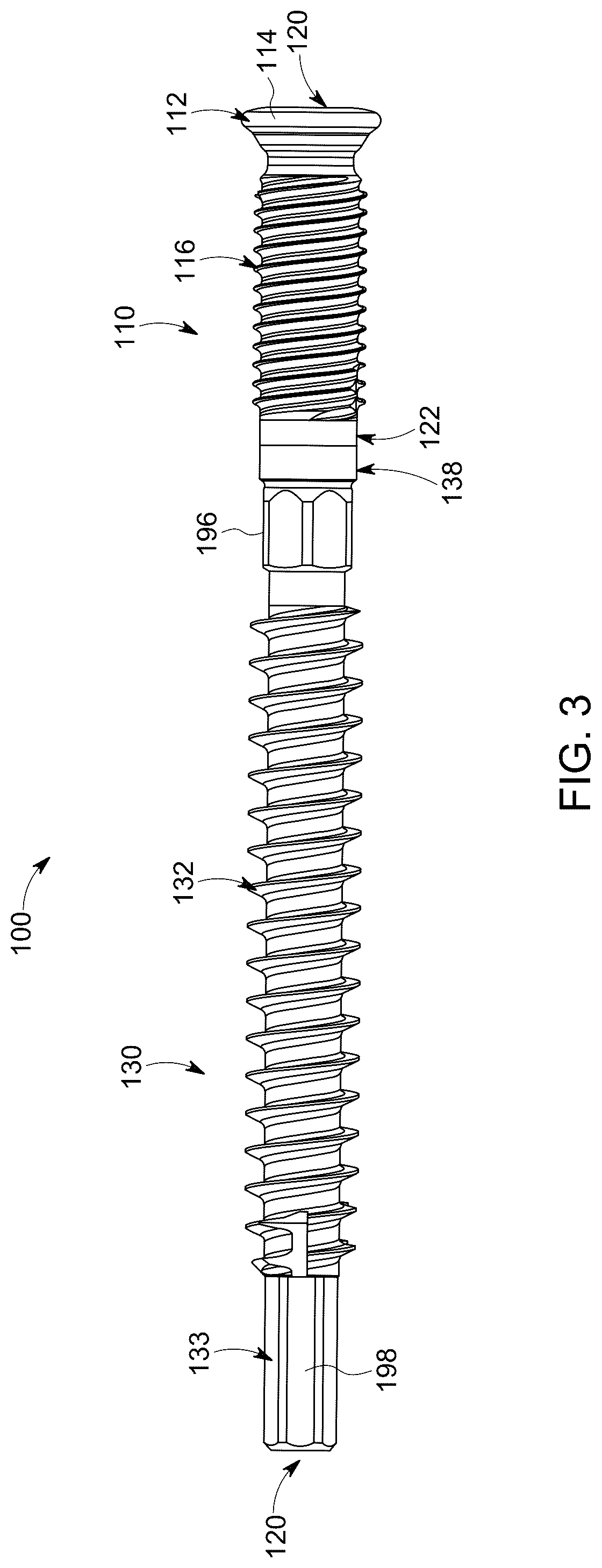 Patent US12303377 Figure 3 – Dynamic fixation implant and method of use